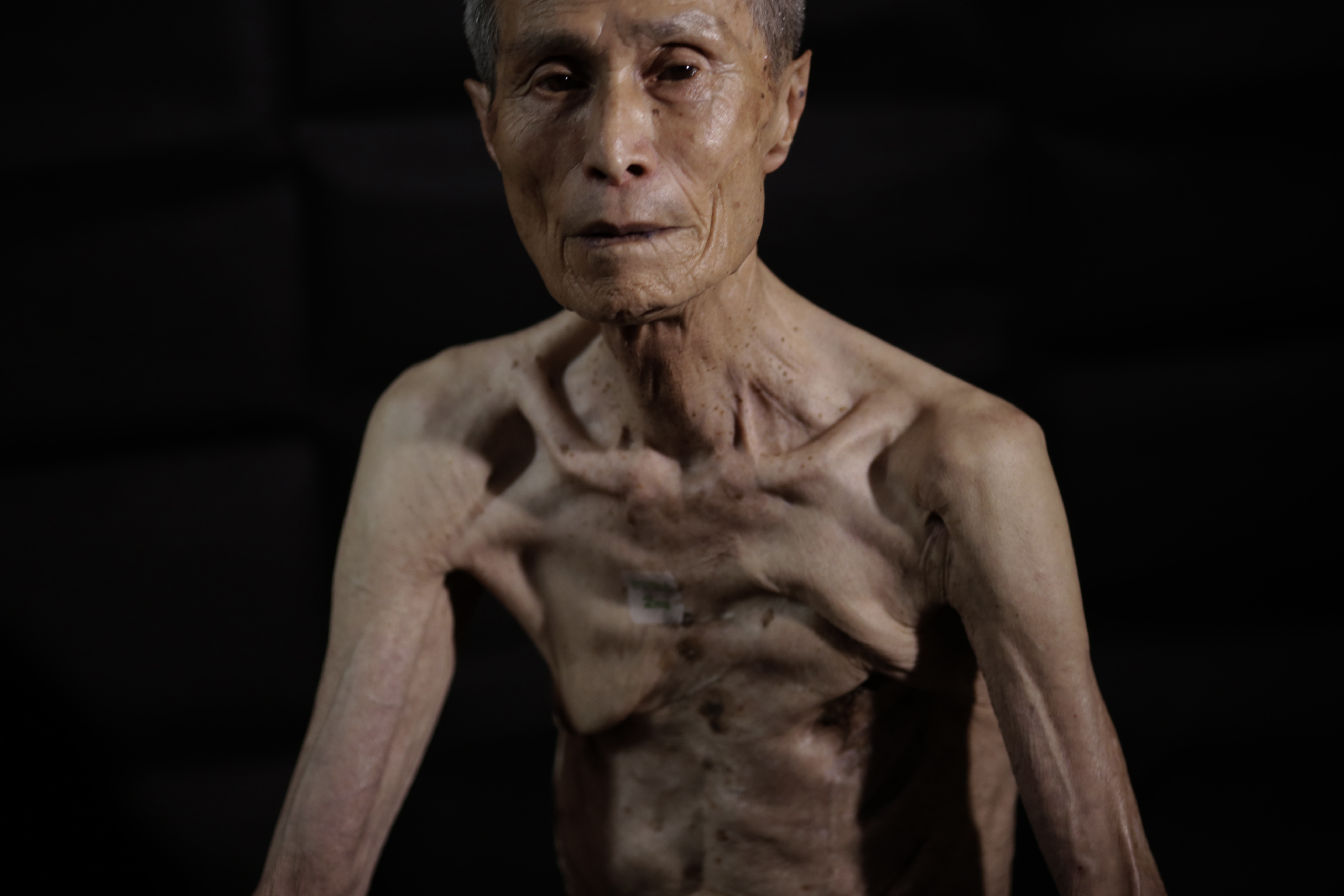 Powerful AP photos show the scars of a survivor of the Nagas