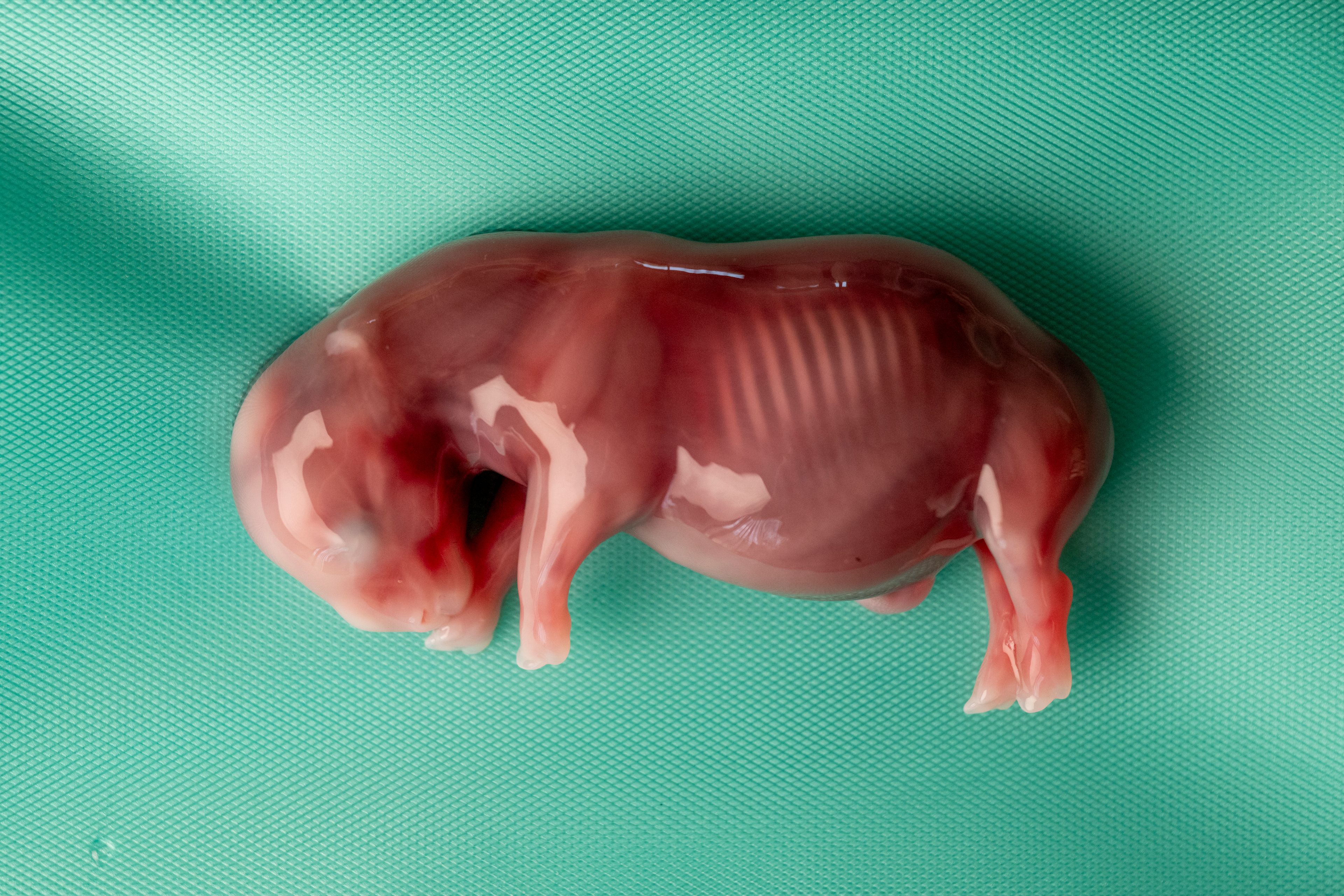 This photograph released by the Leibniz Institute for Zoo and Wildlife Research shows a white rhinoceros embryo that was created in a lab from an egg and sperm that had been previously collected from other rhinos and later transferred into a southern white rhino surrogate mother, in Kenya Nov. 29, 2023. A rhinoceros is pregnant through embryo transfer in the first successful use of a method that conservationists said could be used to try to save the nearly extinct northern white rhino subspecies. (Jon Juarez/IZW via AP)