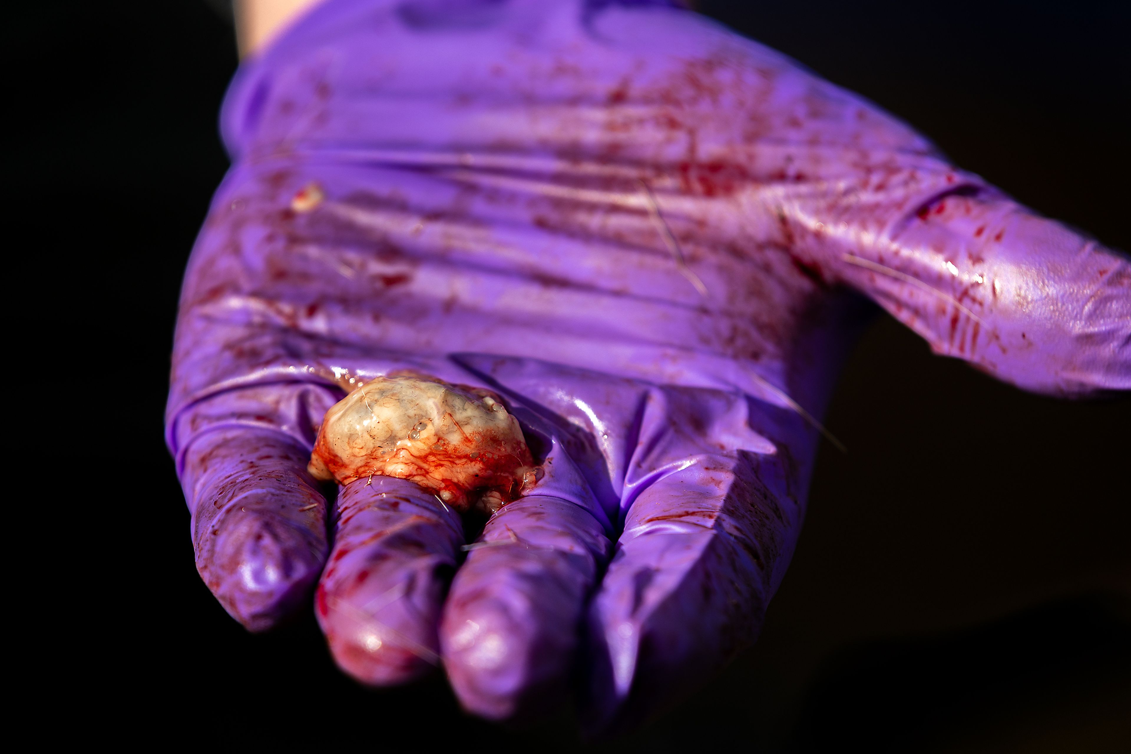 Iver Hull, the regional wildlife biologist for the Idaho Fish and Game, holds a deer’s freshly removed lymph node Monday at the US Slate Creek Ranger Station in White Bird. The lymph nodes from 150 culled deer are being tested for chronic wasting disease, a contagious and fatal neurological disease recently discovered in the Slate Creek area south of White Bird.