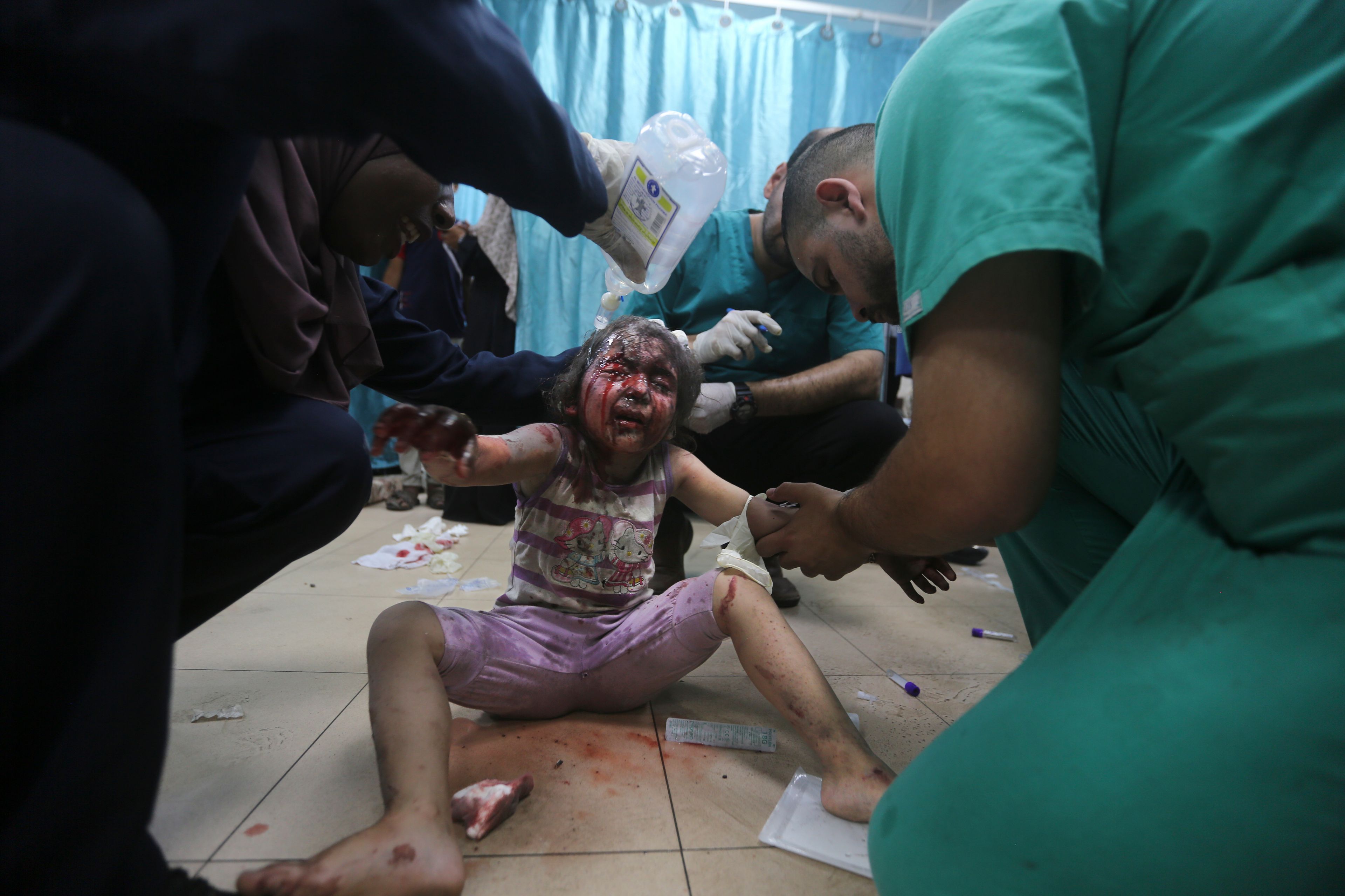 Palestinians wounded in the Israeli bombardment of the Gaza Strip arrive at al-Aqsa Hospital in Deir al-Balah, central Gaza Strip, Saturday, June 8, 2024. (AP Photo/Ismael Abu Dayyah)