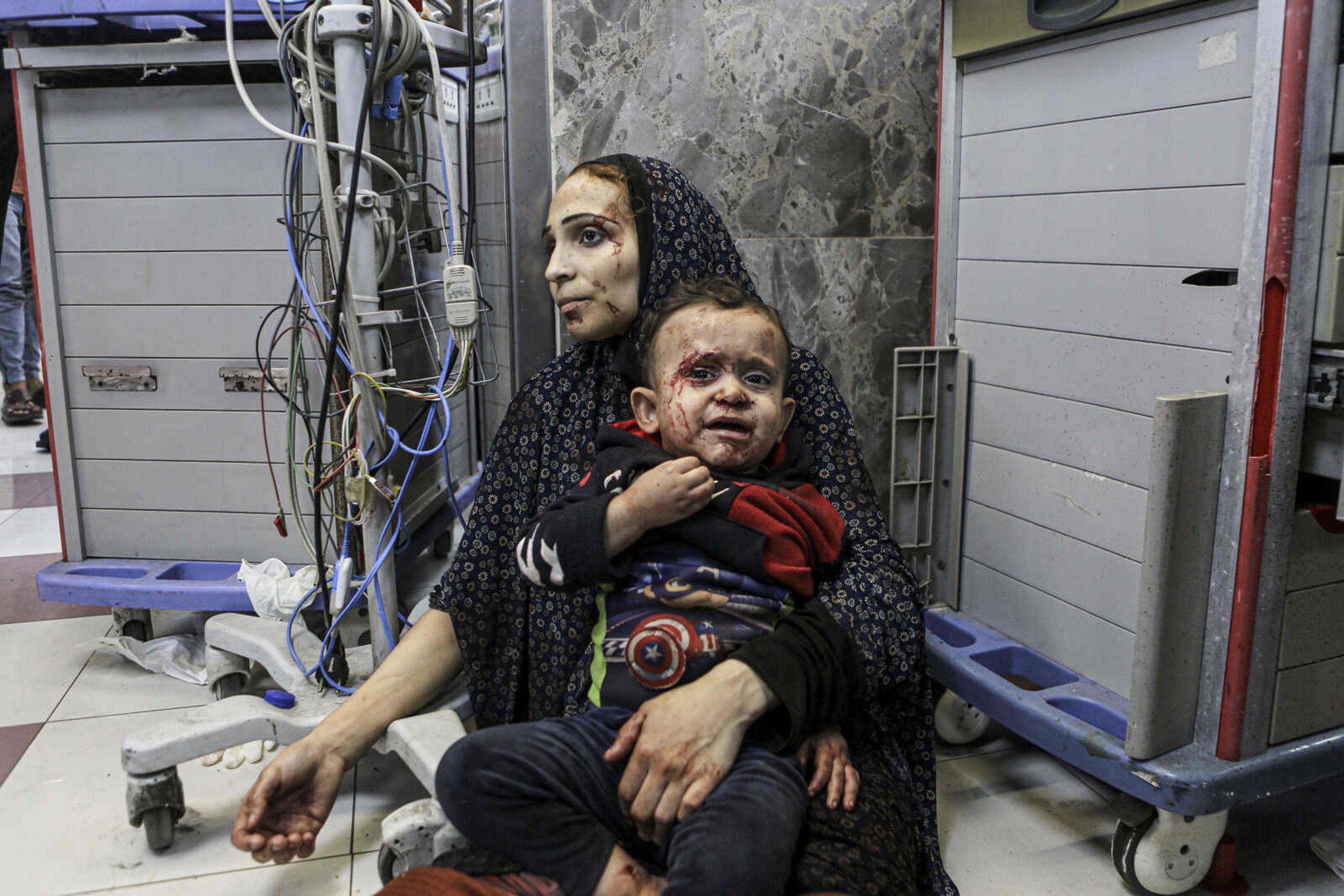 Wounded Palestinians wait for treatment Tuesday at the al-Shifa hospital in Gaza City, central Gaza Strip.