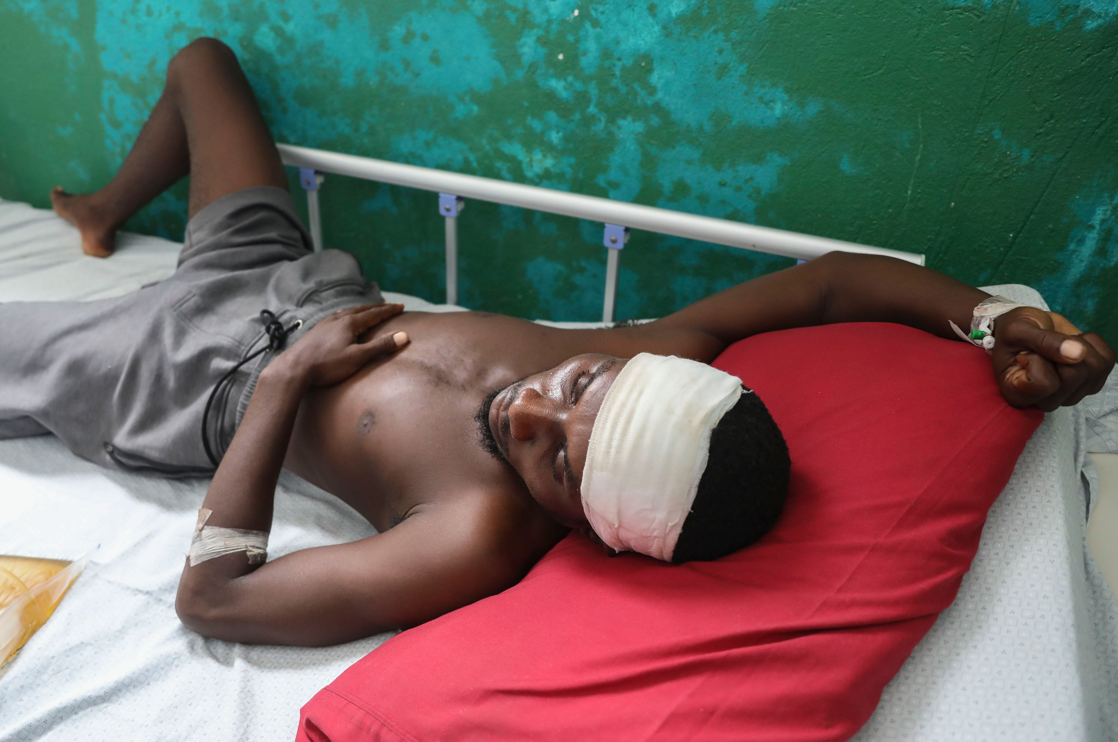 Germain Rivaldo, wounded by a bullet during armed gang attacks, lies on a bed at Saint Nicolas hospital in Saint-Marc, Haiti, Sunday, Oct. 6, 2024. (AP Photo/Odelyn Joseph)