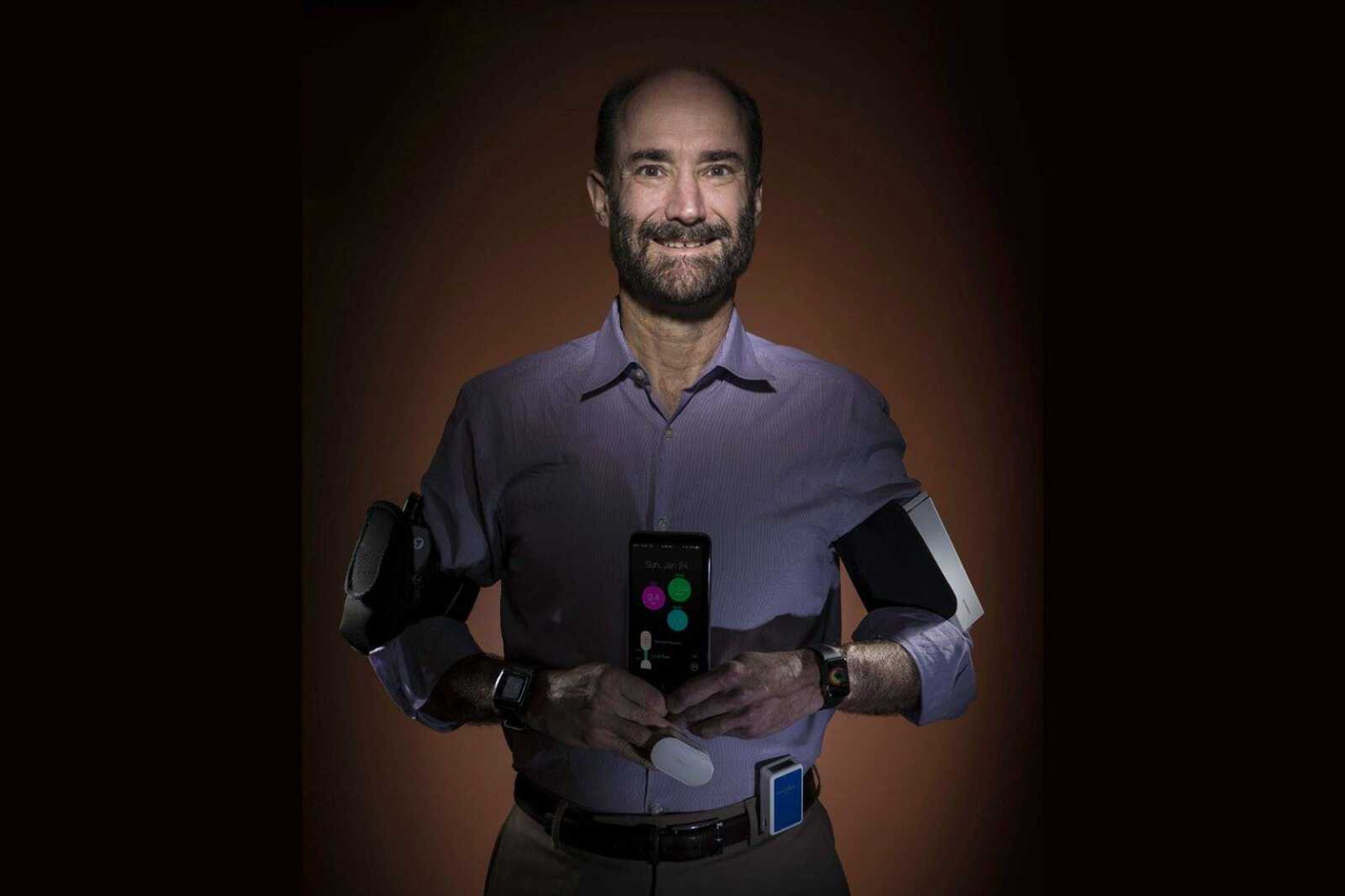 Michael Snyder, professor and chair of genetics at the Stanford University School of Medicine, sports wearable gadgets. Wearable gadgets gave a Snyder an early warning he was getting sick before he felt any symptoms of Lyme disease.