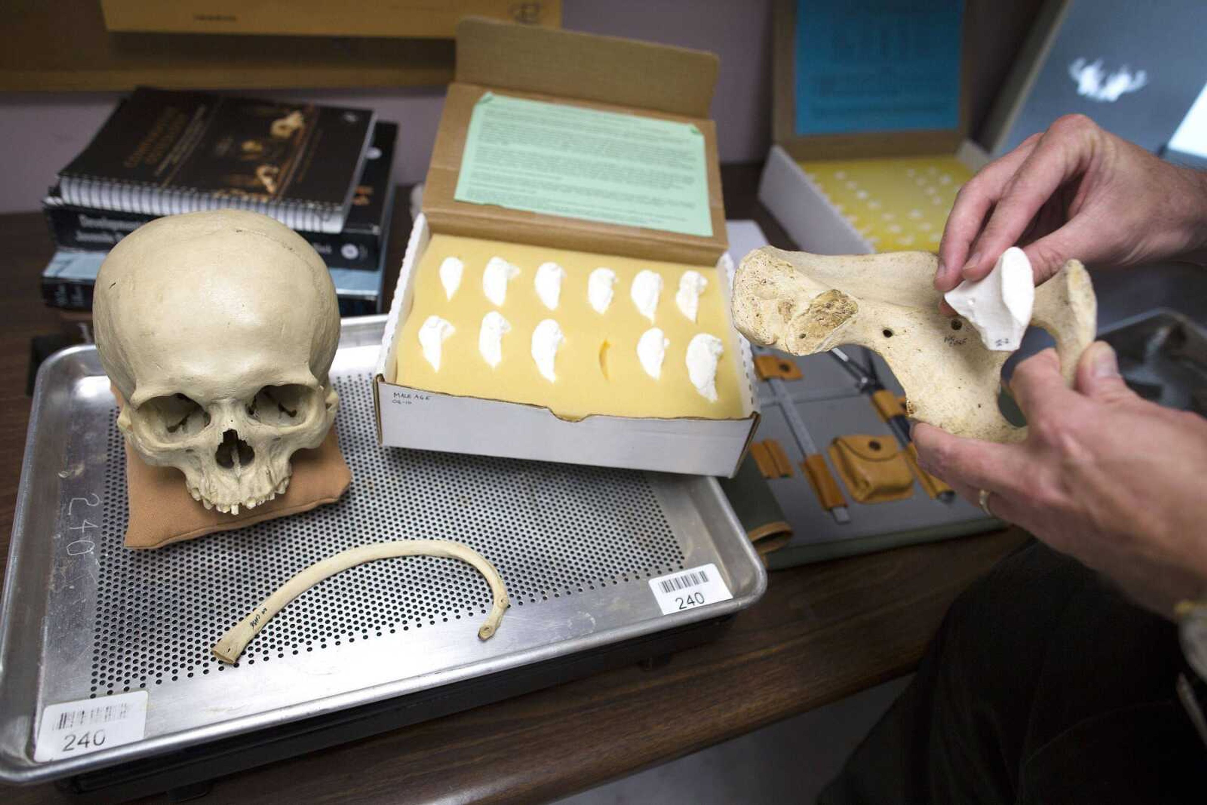 Anatomical specimens are displayed Aug. 14 at the City of New York Office of Chief Medical Examiner where anthropologists routinely work to reveal the people behind unclaimed and unidentified remains in New York. (John Minchillo ~ Associated Press)