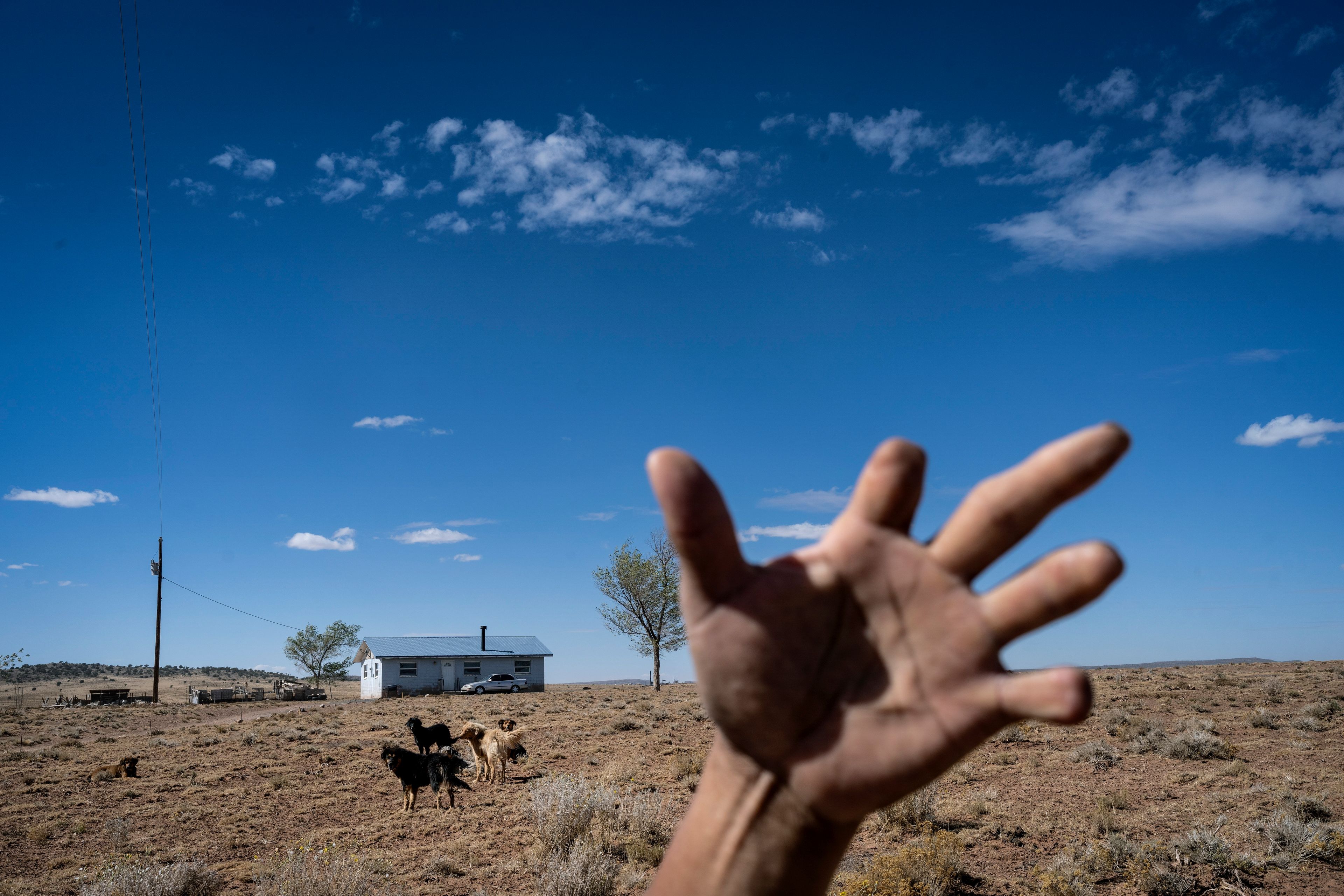 Goat herder Richard Begay holds up his hand showing his amputated fingers, on the Navajo Nation in Dilkon, Ariz., Wednesday, Oct. 16, 2024. (AP Photo/Rodrigo Abd)