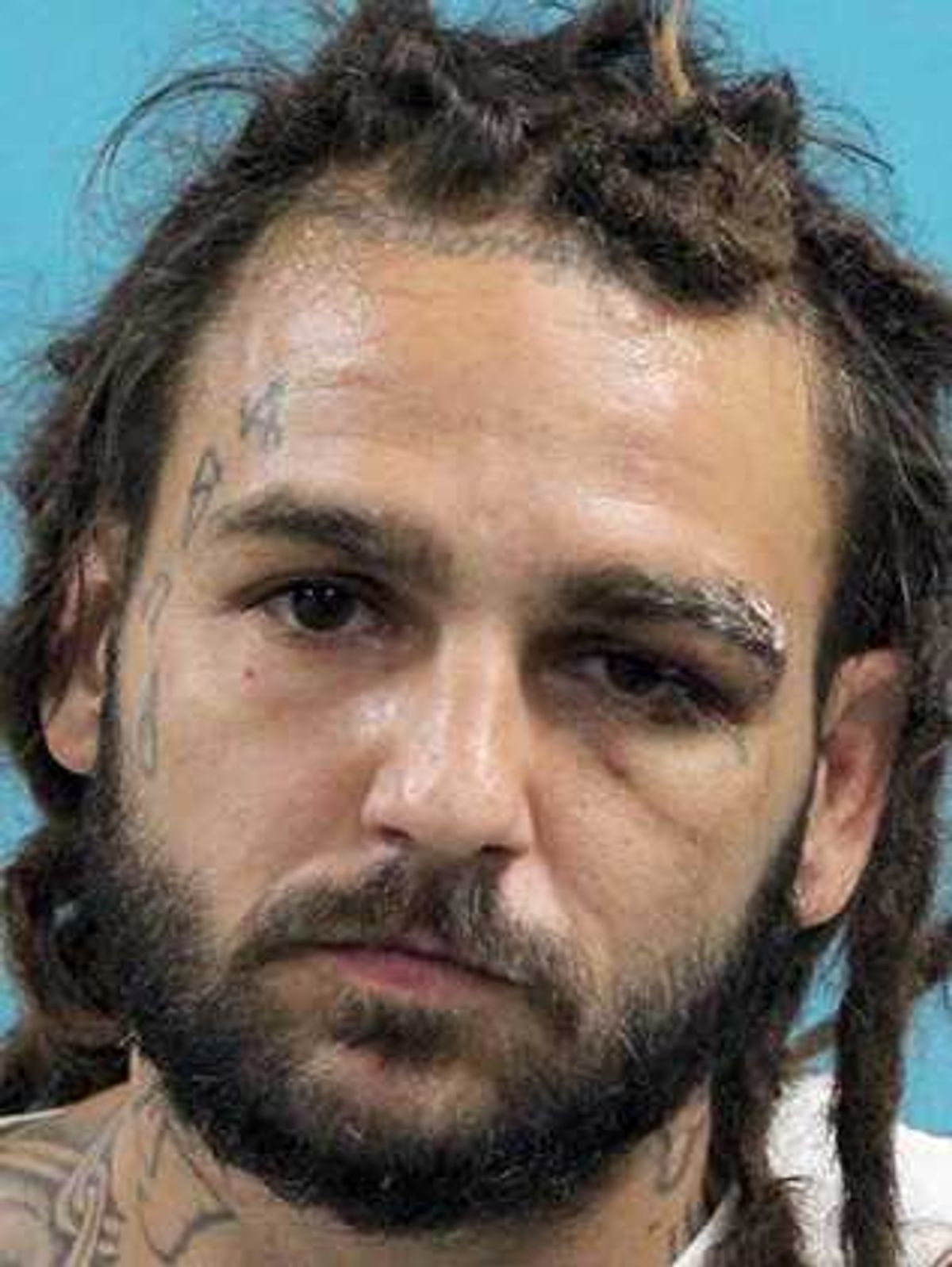Assault victim dies; charge against suspect upgraded to second-degree...