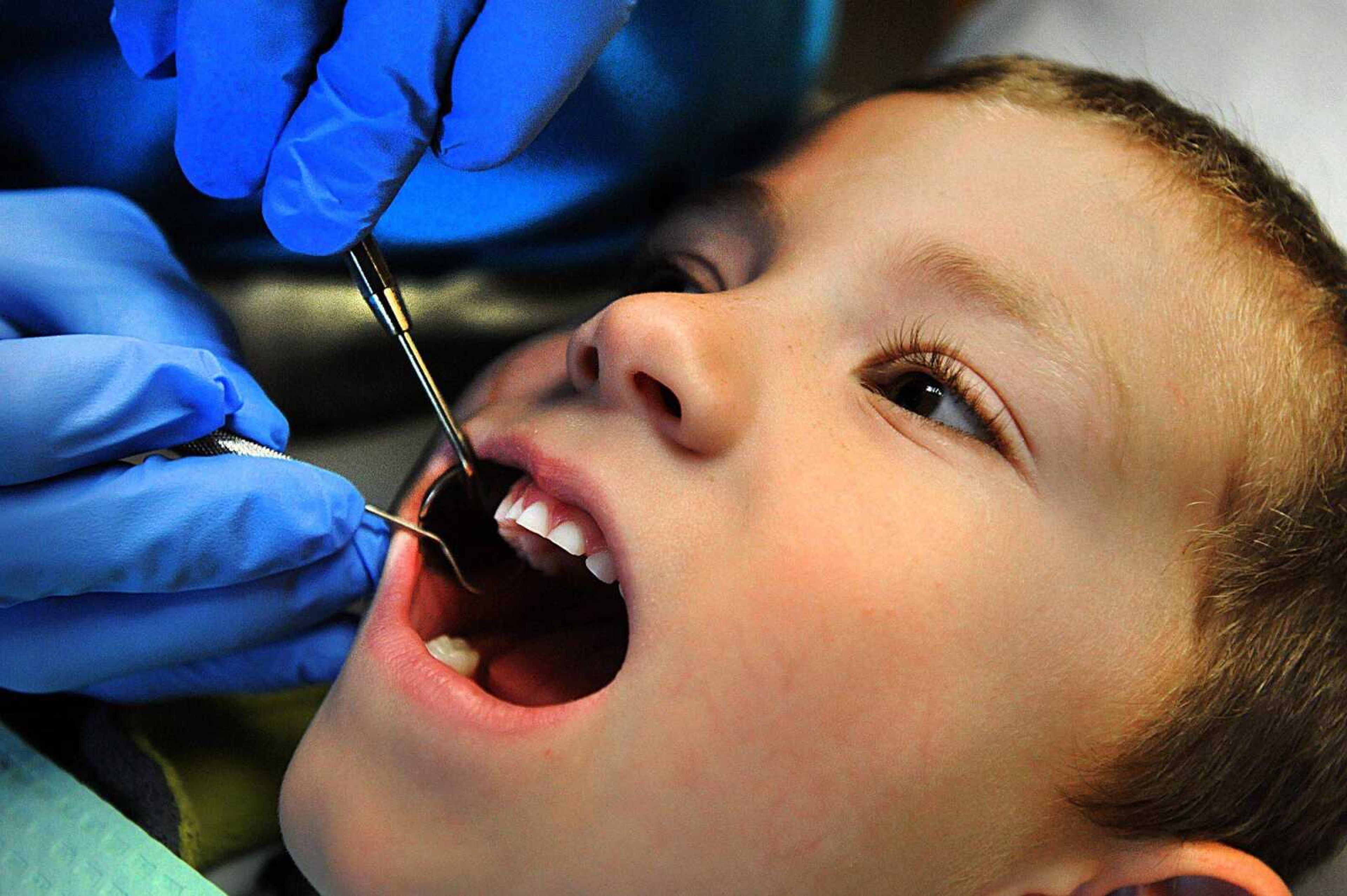 Weston Stroud, 5, opens wide during his dental exam Monday morning at Jackson Dental. (Laura Simon)