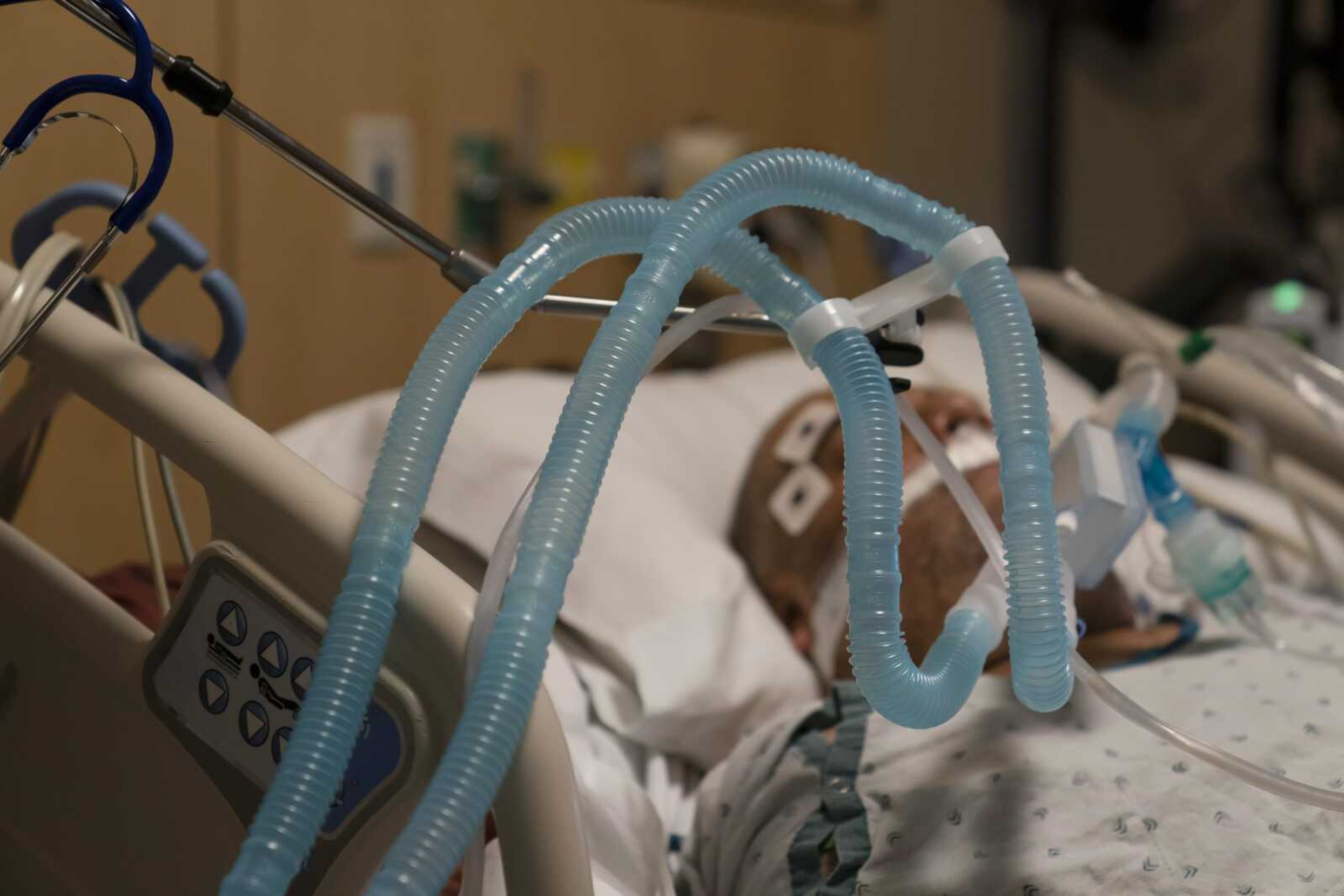 Ventilator tubes are attached to a COVID-19 patient at Providence Holy Cross Medical Center in the Mission Hills section of Los Angeles in November. U.S. deaths from COVID-19 are falling again as the nation recovers from the winter surge.