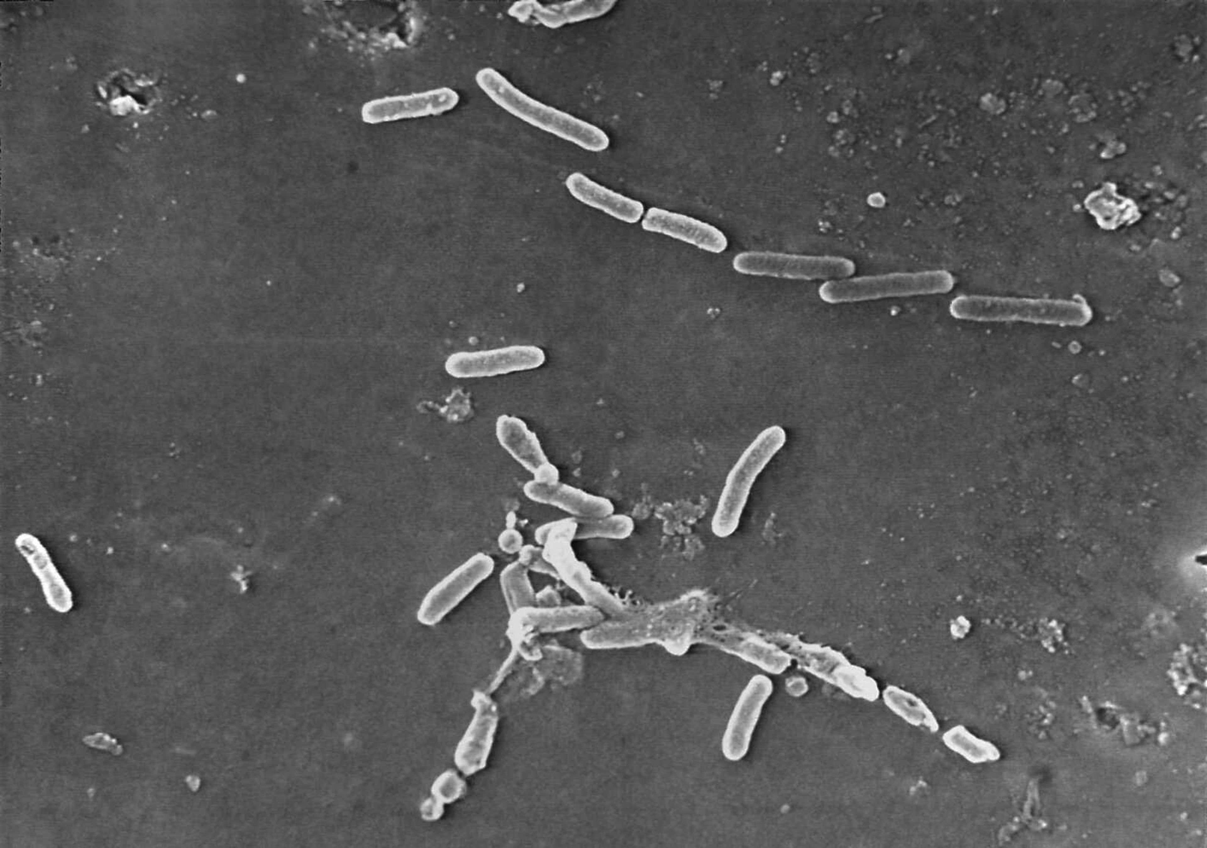 This scanning electron microscope image shows rod-shaped Pseudomonas aeruginosa bacteria. U.S. health officials are advising people to stop using over-the-counter eye drops EzriCare Artificial Tears that have been linked to an outbreak of drug-resistant infections of Pseudomonas aeruginosa. The Centers for Disease Control and Prevention on Wednesday night sent a health alert to physicians, saying the outbreak includes at least 55 people in 12 states. One died.