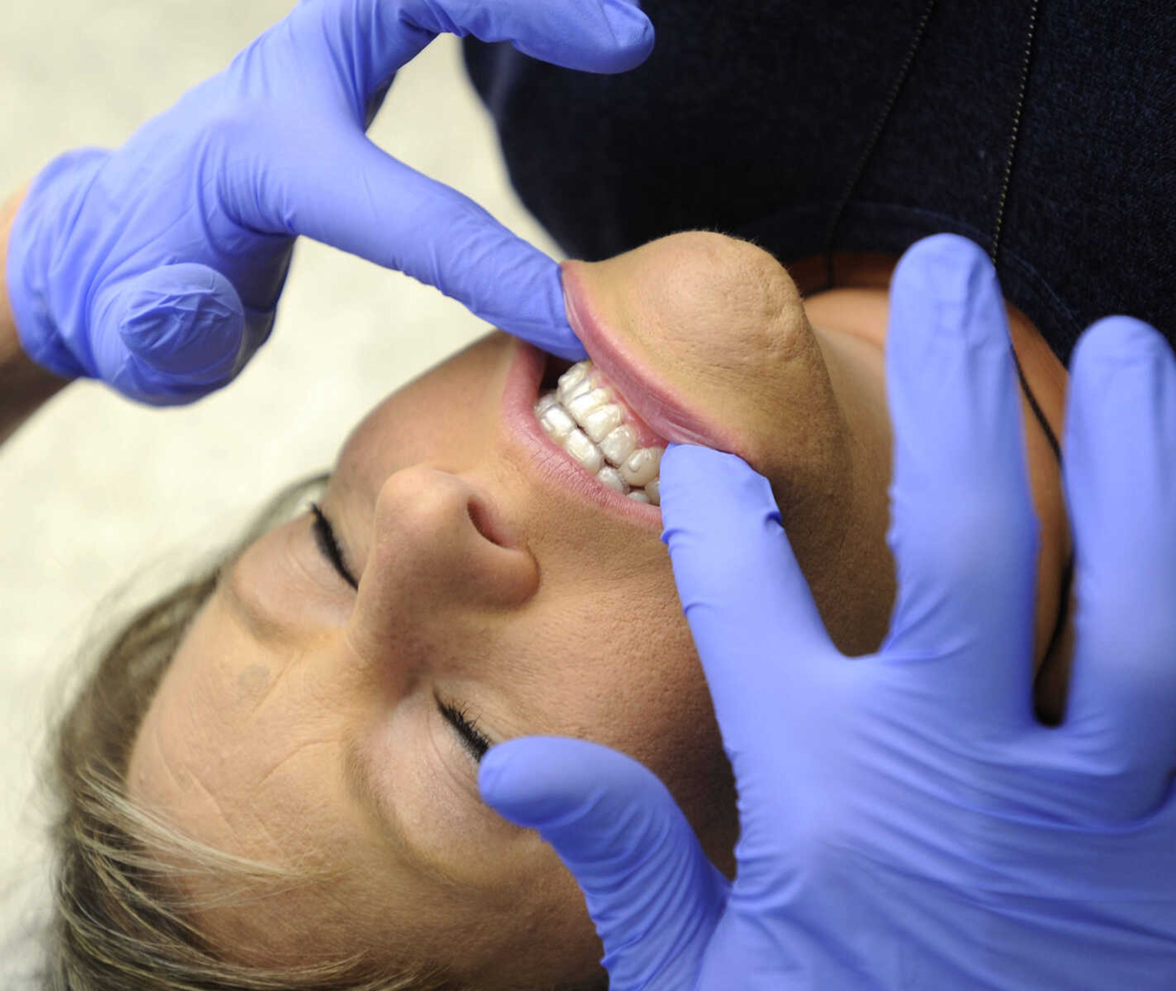 Dr. Nathan McGuire inserts a new aligner for Angel Hillman during an orthodontic treatment with Invisalign. (Fred Lynch)