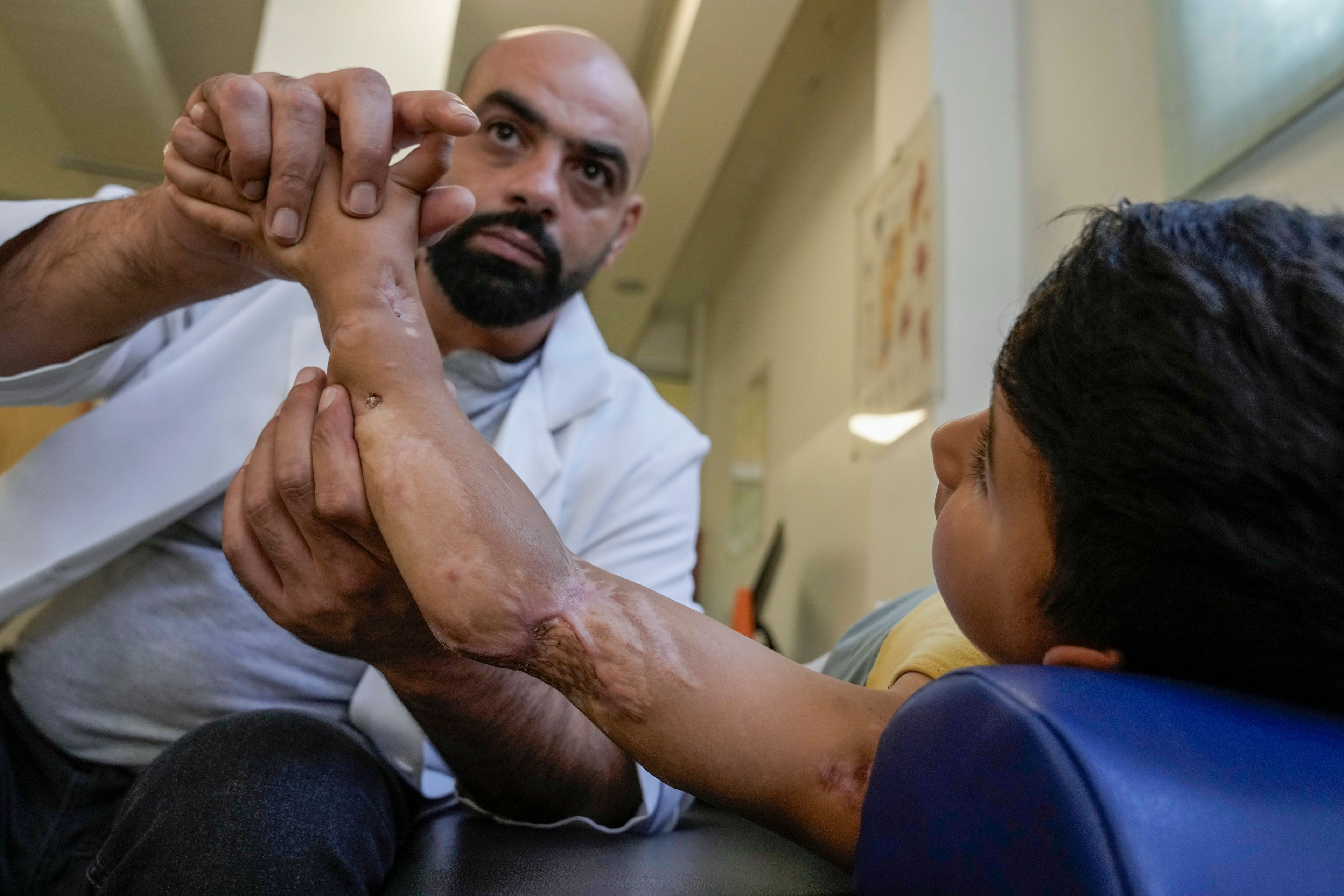 Adam Afana, 5, who was brought to Lebanon from the Strip for treatment after he nearly lost his left arm in an Israeli airstrike that killed his father and sister, receives physiotherapy at a clinic in Mar Elias Palestinian refugee camp in Beirut, Lebanon, Wednesday, Sept. 4, 2024. (AP Photo/Bilal Hussein)