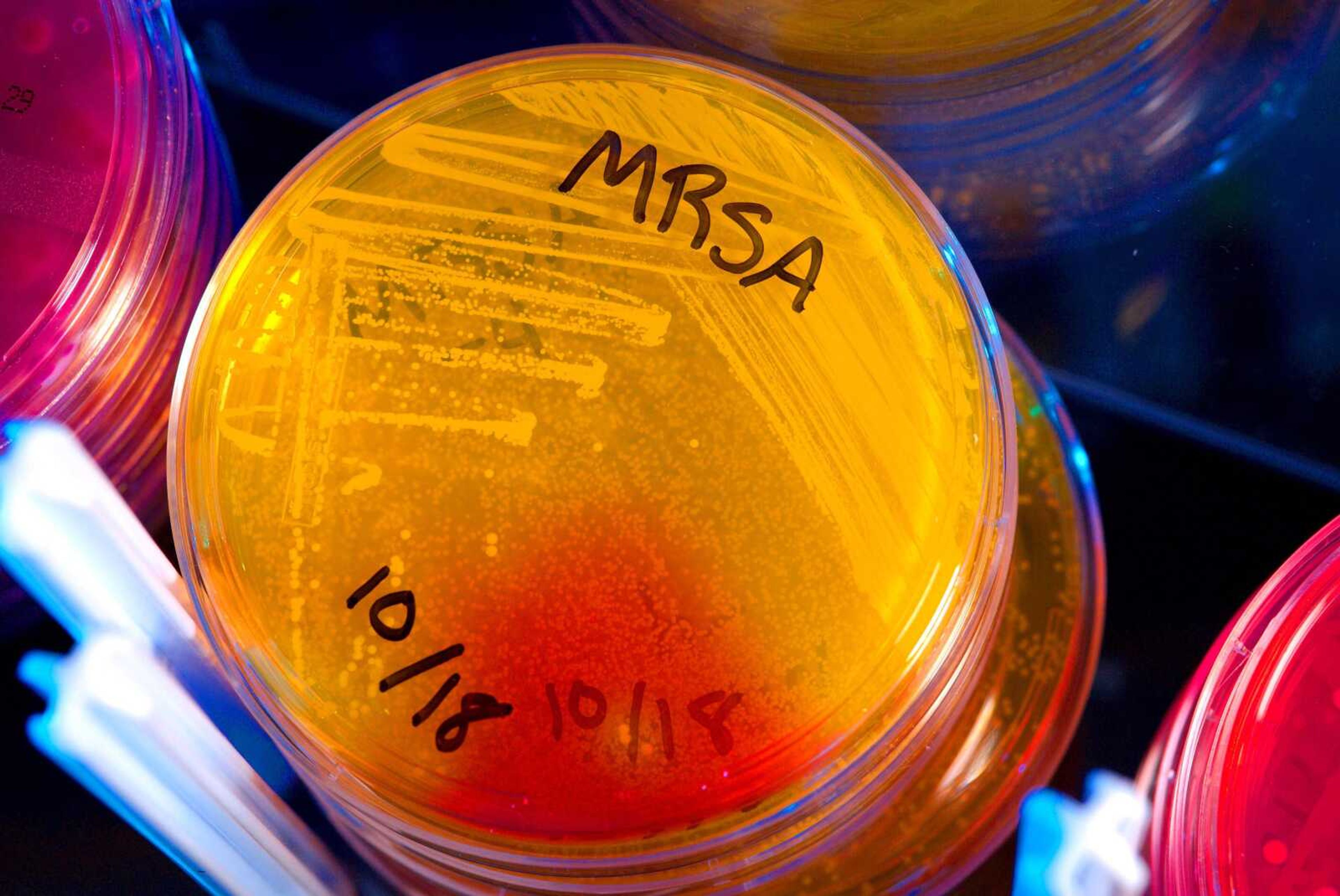 This undated photo provided by the Center for Disease Control (CDC) shows plates of Methicillin-Resistant Staphylococcus Aureus (MRSA) in CDC&#237;s healthcare-associated infections laboratory. A recent study of hospitals released Wednesday, May 29, 2013, found that decontaminating all intensive care patients by using antiseptic wipes and giving them an antibiotic nose ointment dramatically reduced bloodstream infections from germs that include MRSA. (AP Photo/Center for Disease Control)