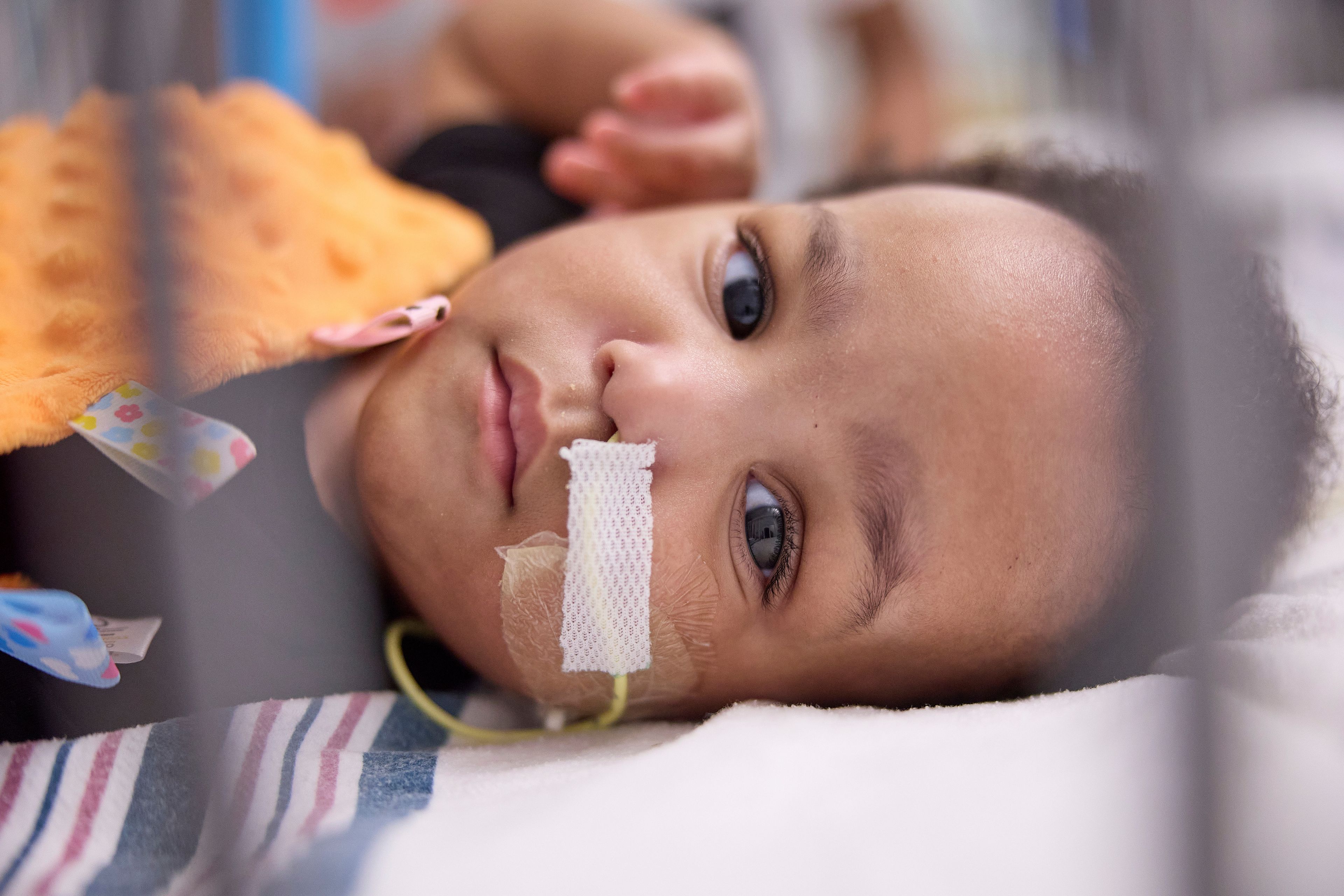 This undated photo provided by the Children’s Hospital of Philadelphia in October 2024 shows one of the previously conjoined Ruffin twins after separation surgery at the Children’s Hospital of Philadelphia. (Ed Cunicelli/Children’s Hospital of Philadelphia via AP)