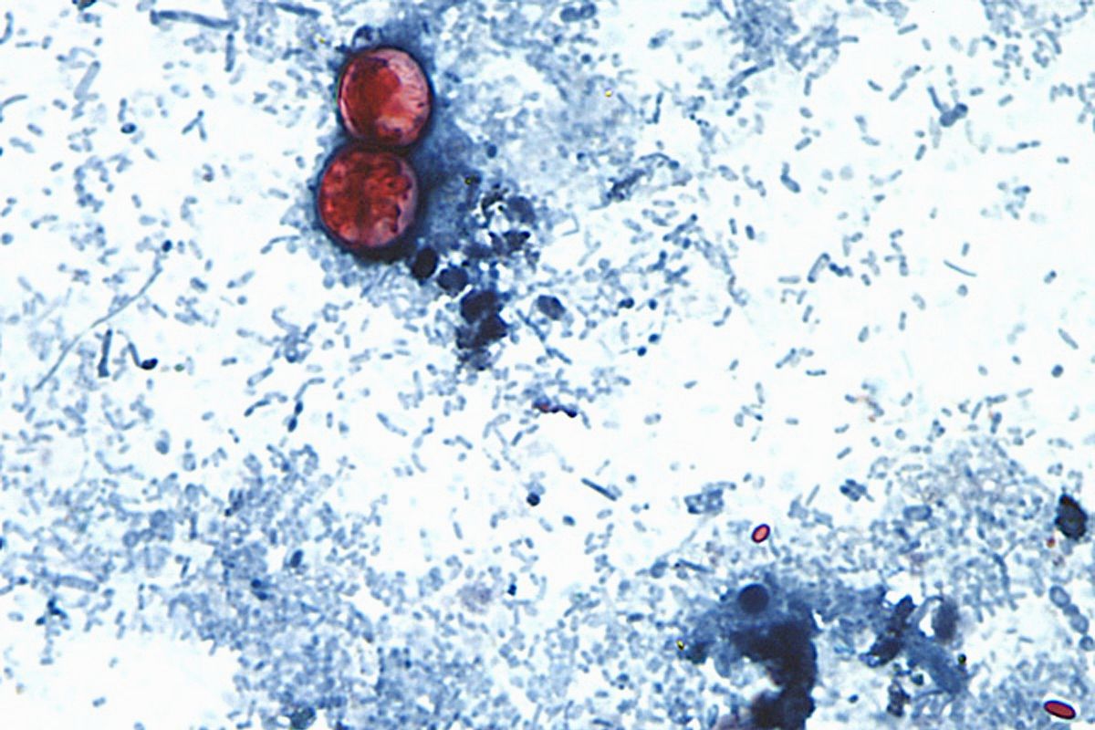 Foodborne illnesses at restaurant chains are rare but can si...