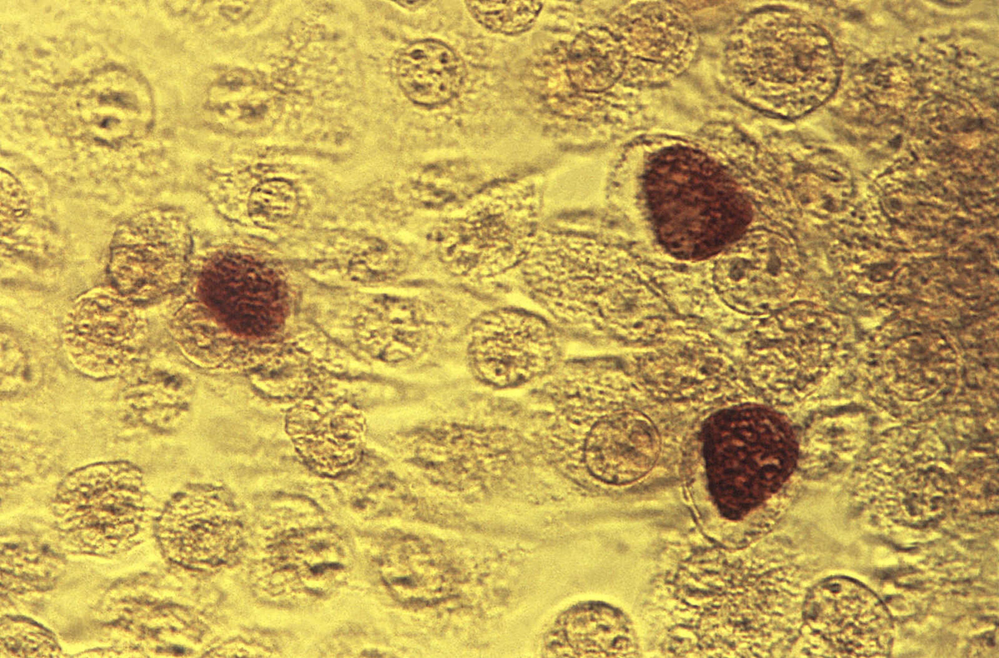 This 1975 microscope image shows Chlamydia trachomatis bacteria.