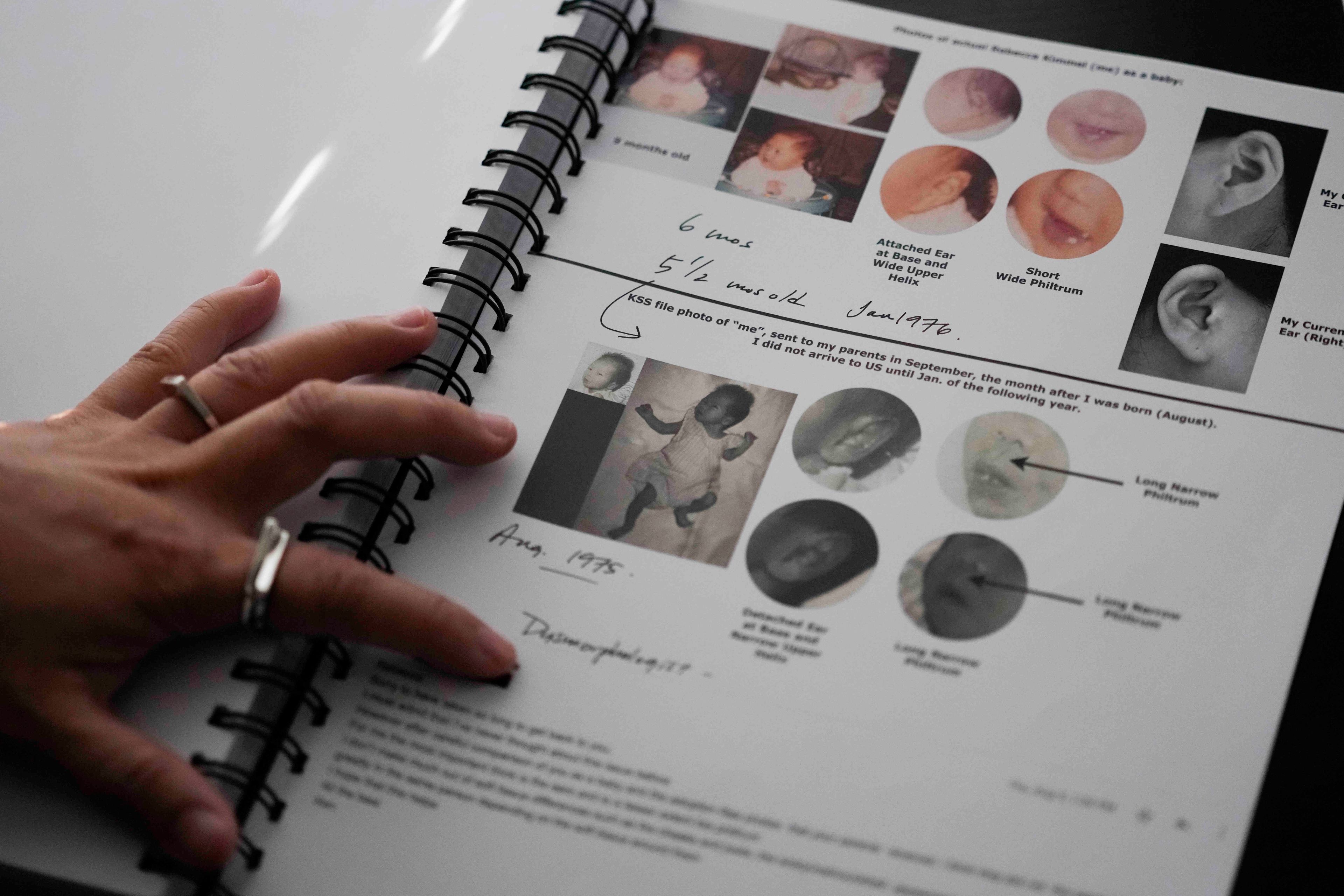 Rebecca Kimmel shows a comparison page of differences in facial features between those taken of her after adoption and the girl used in her adoption file, at her home Saturday, Feb. 3, 2024, in Seattle. Kimmel had her adoption photos cross-checked by a dysmorphologist, a medical expert trained to identify birth defects in children, mainly from facial features. His conclusion: These were likely different girls. (AP Photo/Lindsey Wasson)