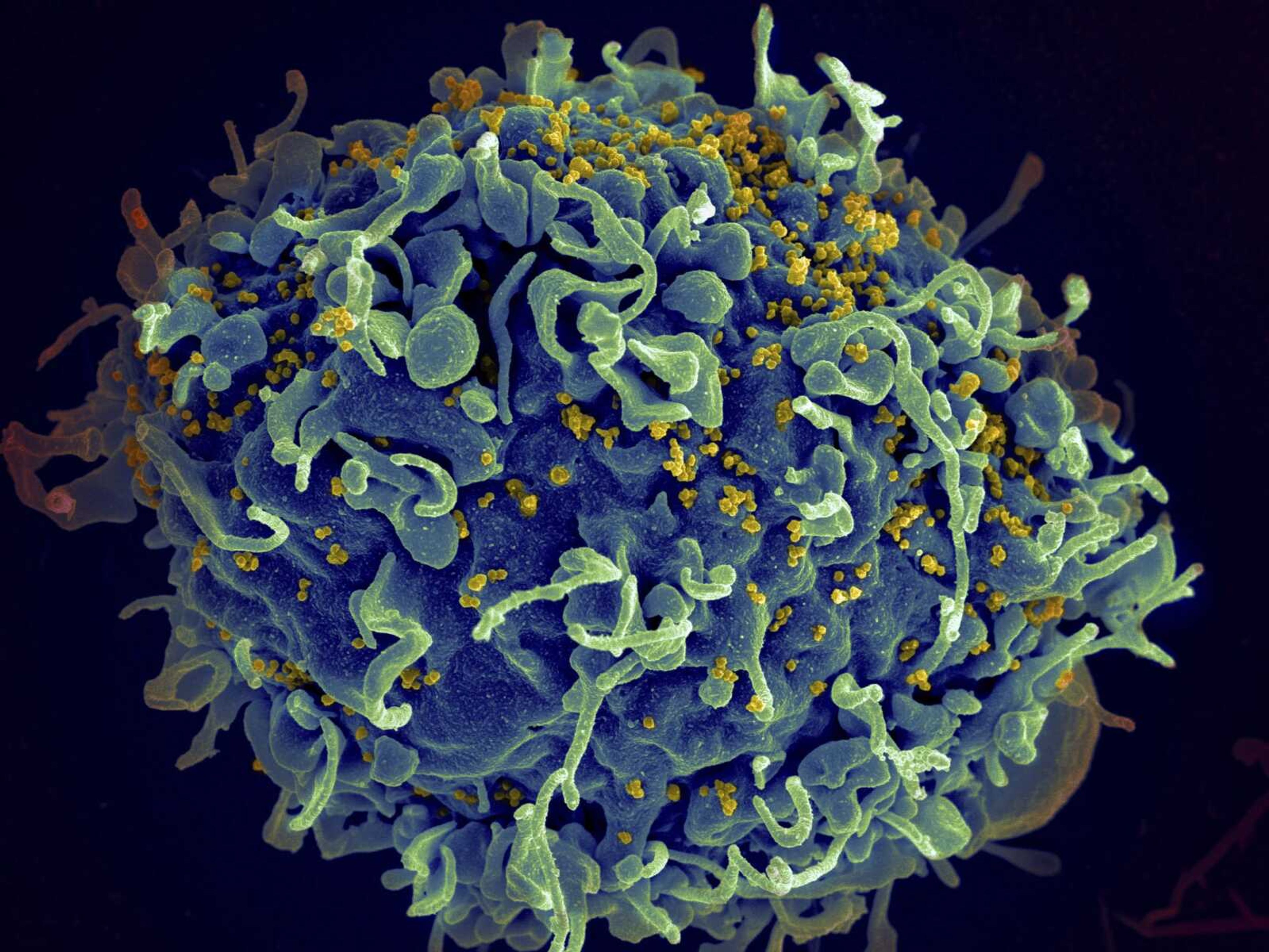 This colorized electron microscope image shows a human T cell, indicated in blue, under attack by HIV, in yellow, the virus that causes AIDS. In a study released Thursday, climate change will result in thousands of new viruses spread among animal species by 2070.