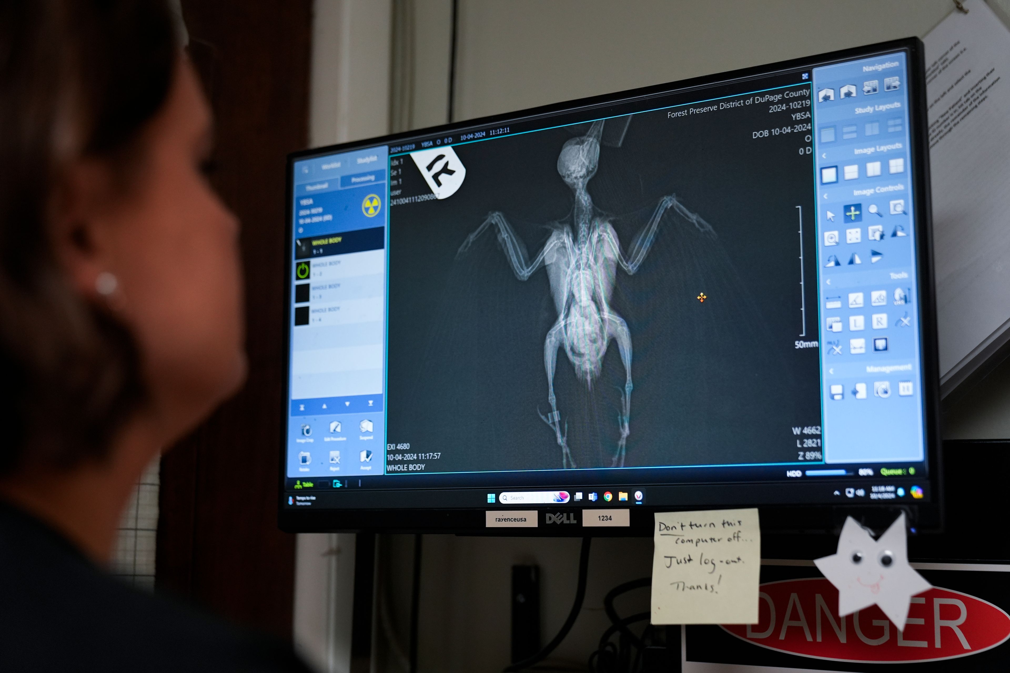 Staff veterinarian Darcy Stephenson looks at an x-ray of a yellow-bellied sapsucker, a kind of migrating woodpecker, and determines it has a fractured ulna, the equivalent of a human forearm bone, at the DuPage Wildlife Conservation Center, Friday, Oct. 4, 2024, in Glen Ellyn, Ill. (AP Photo/Erin Hooley)