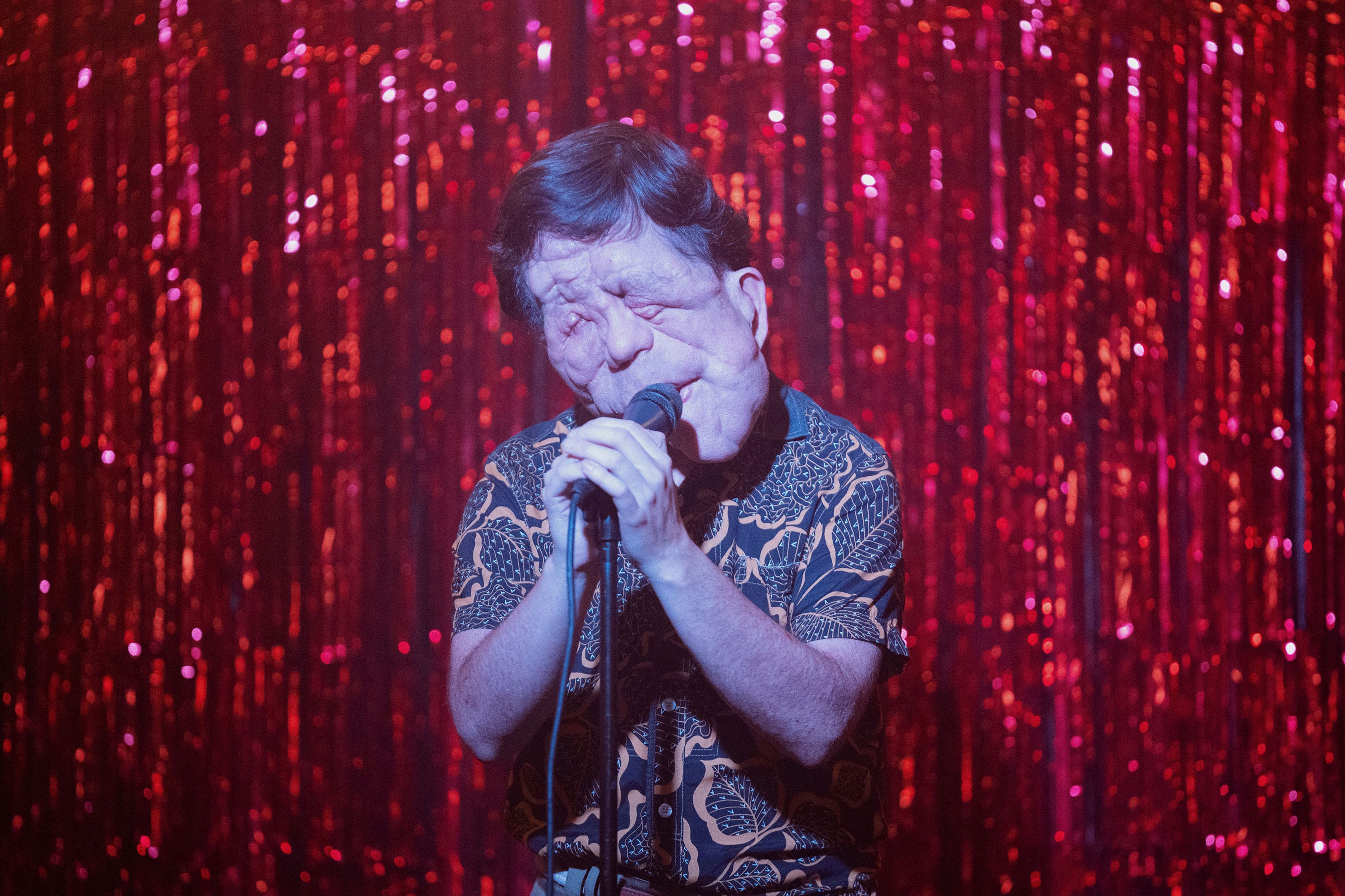 This image released by A24 shows Adam Pearson in a scene from "A Different Man." (Matt Infante/A24 via AP)