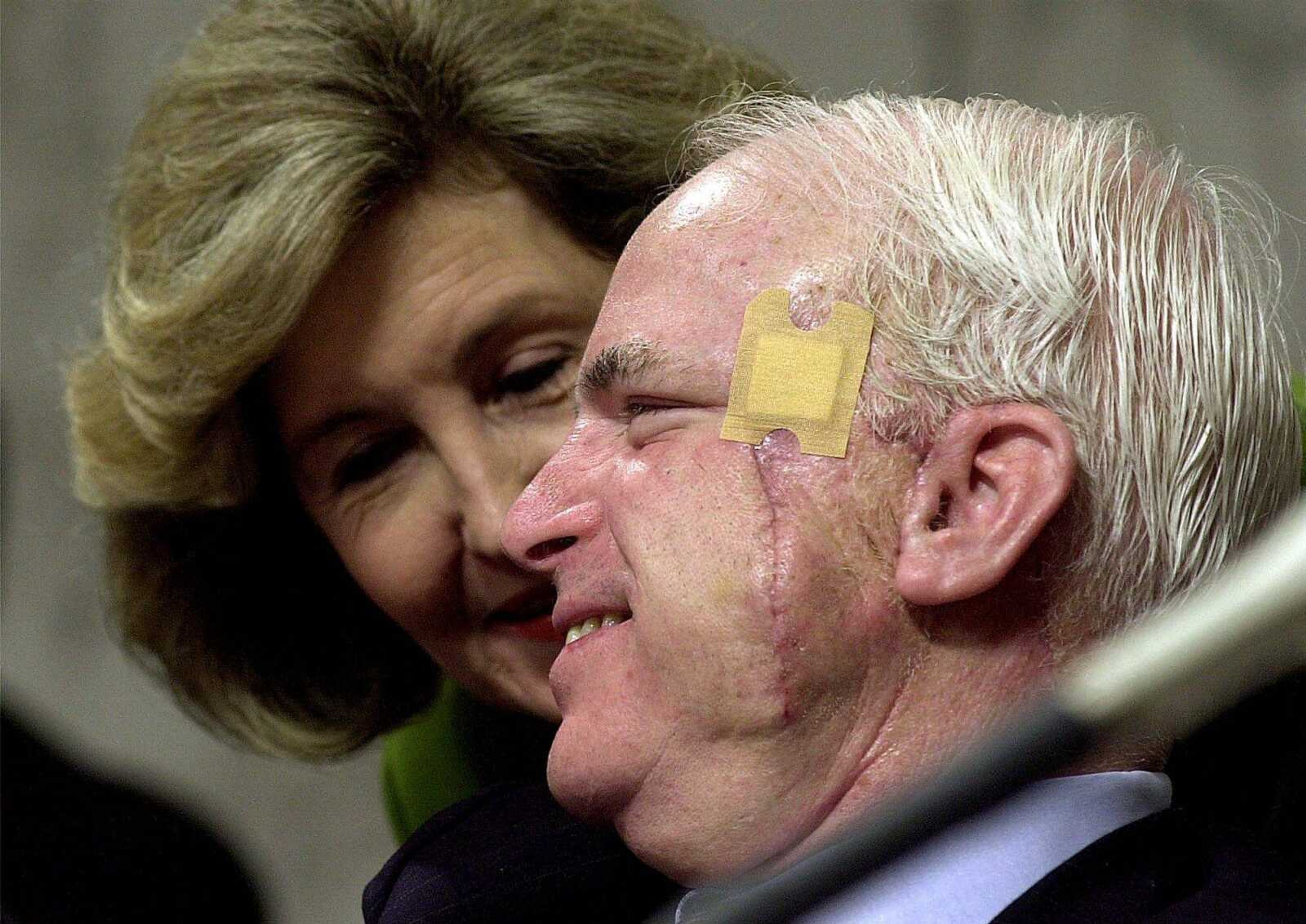 Recovering from skin-cancer surgery Sept. 12, 2000, Sen. John McCain, R-Ariz., right, talks with Sen. Kay Bailey Hutchinson, R-Texas, on Capitol Hill during the Senate Commerce Committee on the Firestone tire recall.