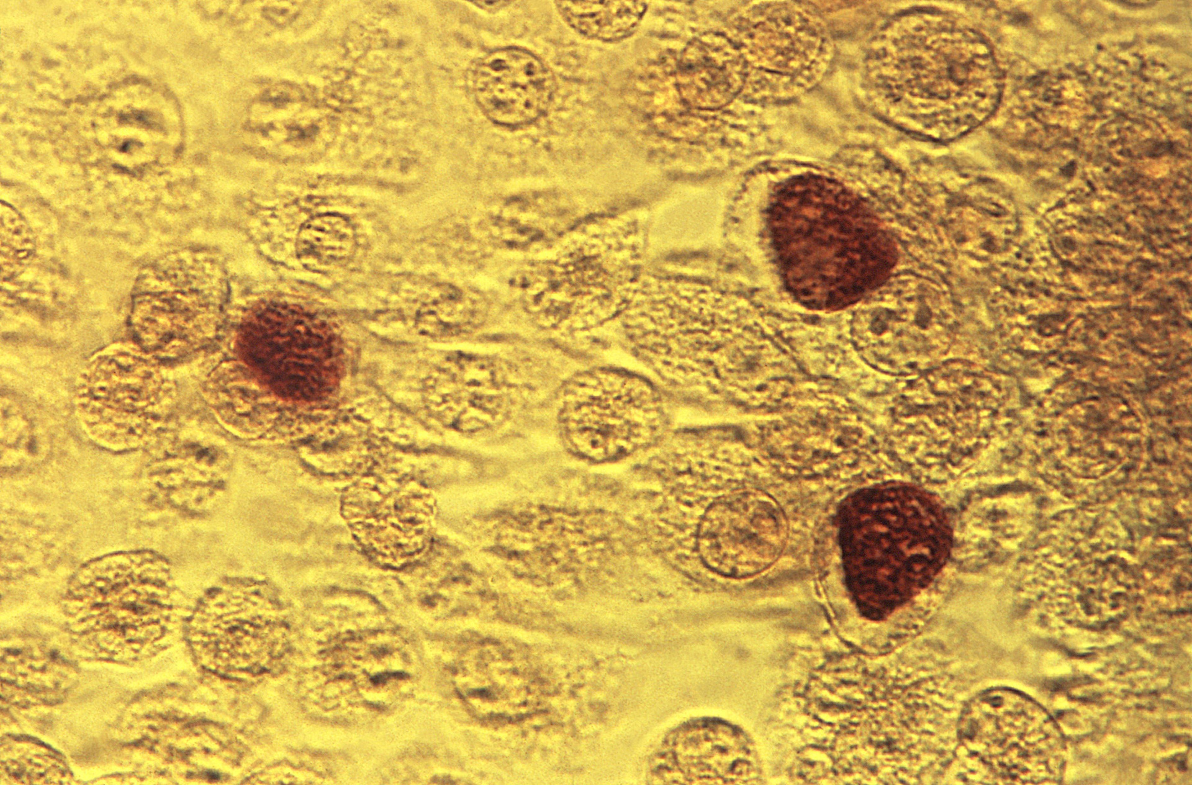 FILE - This 1975 microscope image made available by the the Centers for Disease Control and Prevention shows Chlamydia trachomatis bacteria. (Dr. E. Arum, Dr. N. Jacobs/CDC via AP)