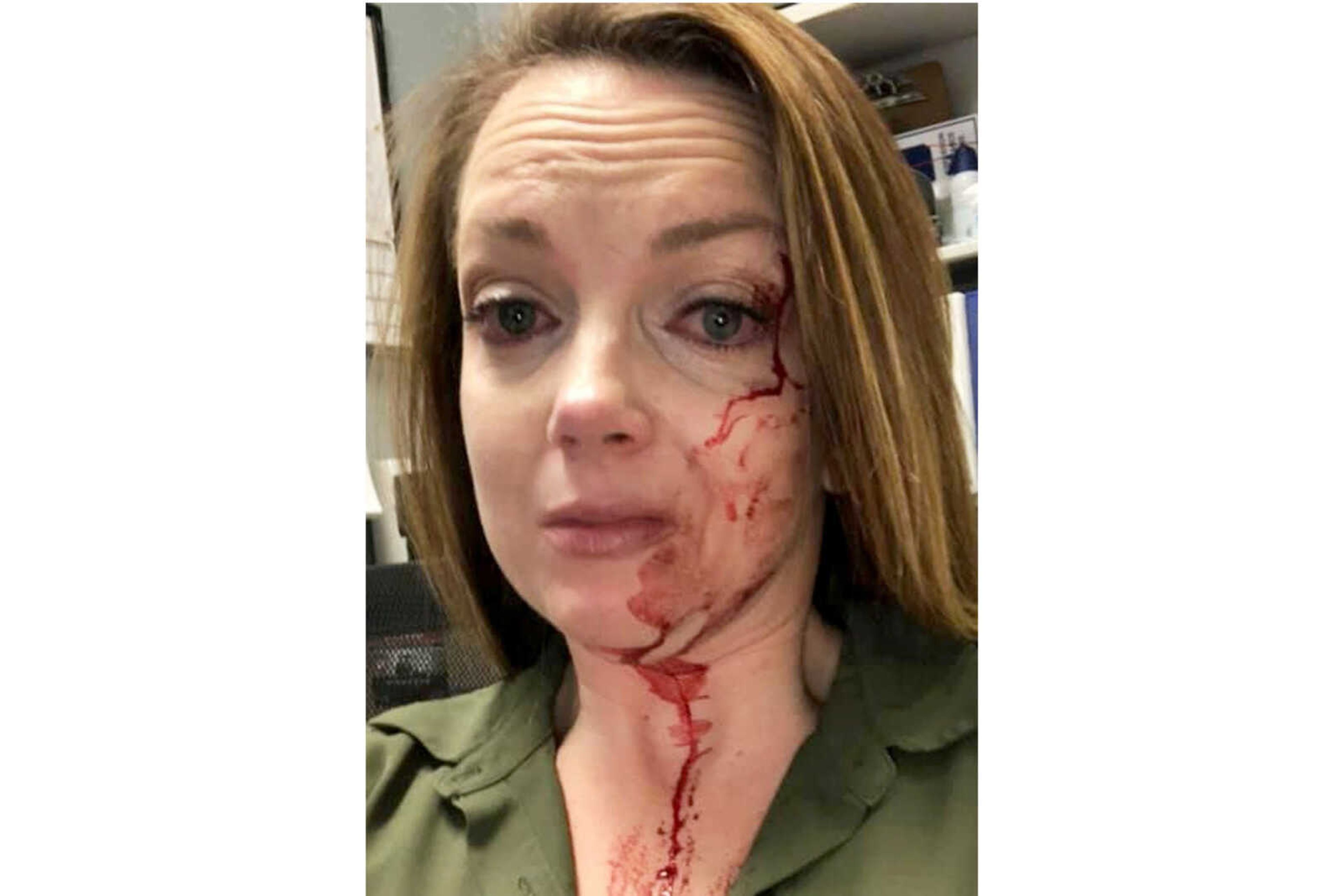 This selfie by Samantha Clarke shows her bruised and bloodied face after she was assaulted by a shopper at the retail store she manages May 6 in Modesto, California. Despite the abuse and occasional threats, Clarke says she never expected to be sucker-punched and knocked to the floor by an angry shopper as happened last month.