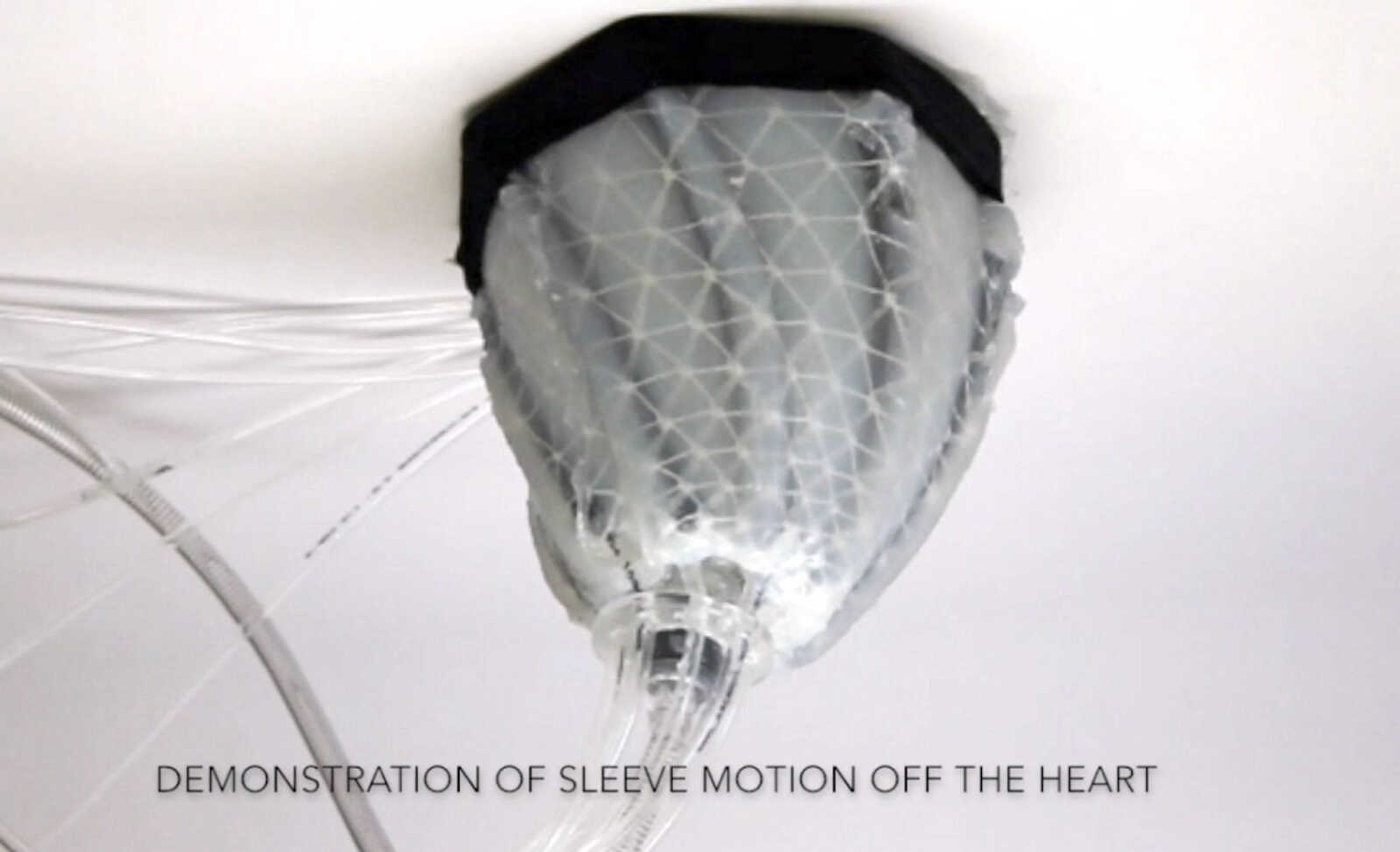 This image from video shows a robotic sleeve designed to encase a diseased heart and gently squeeze it to help it better pump blood.