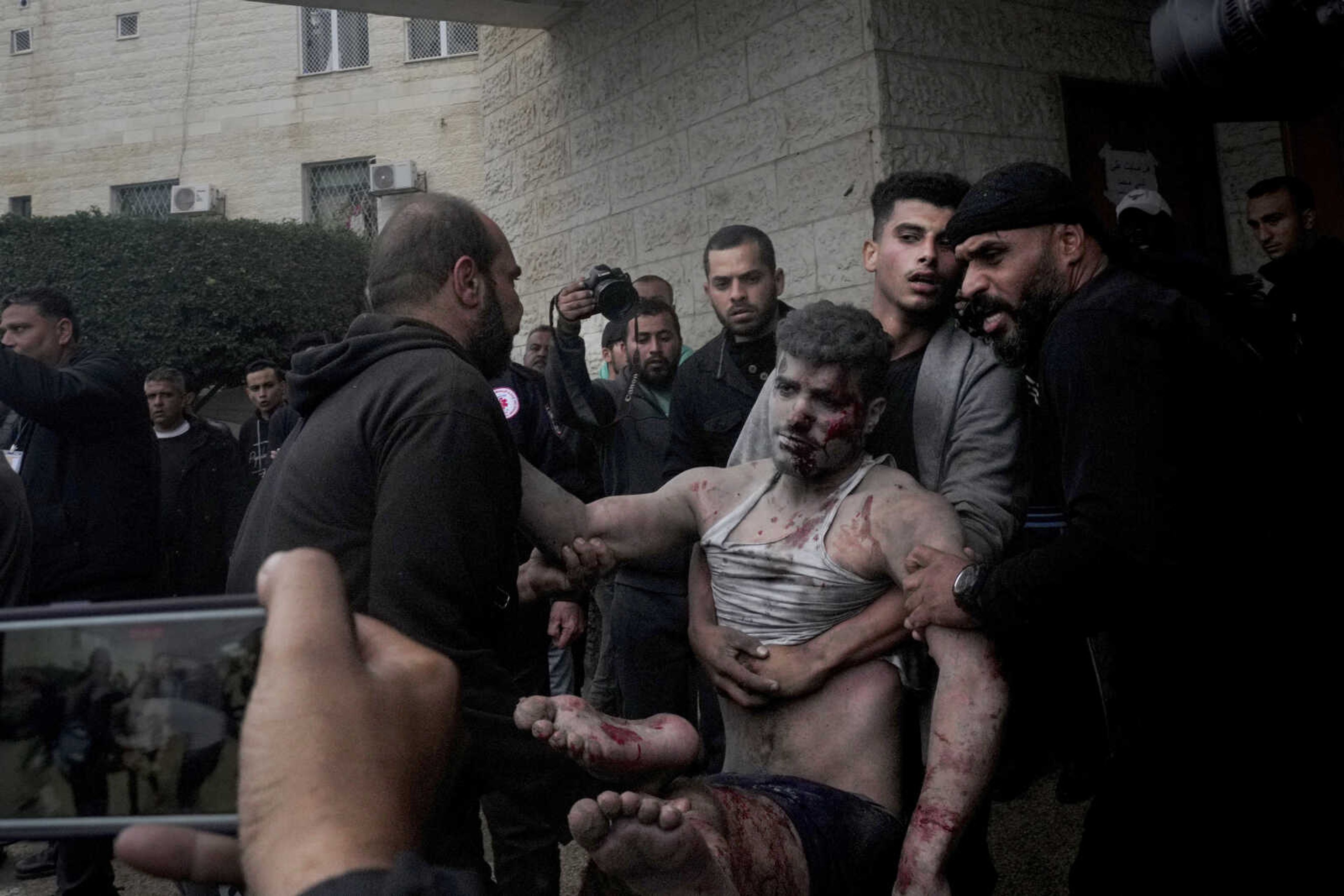 Palestinians wounded in the Israeli bombardment of the Gaza Strip are brought to the hospital in Deir al Balah on Tuesday, Dec. 5, 2023. (AP Photo/ Hatem Moussa)