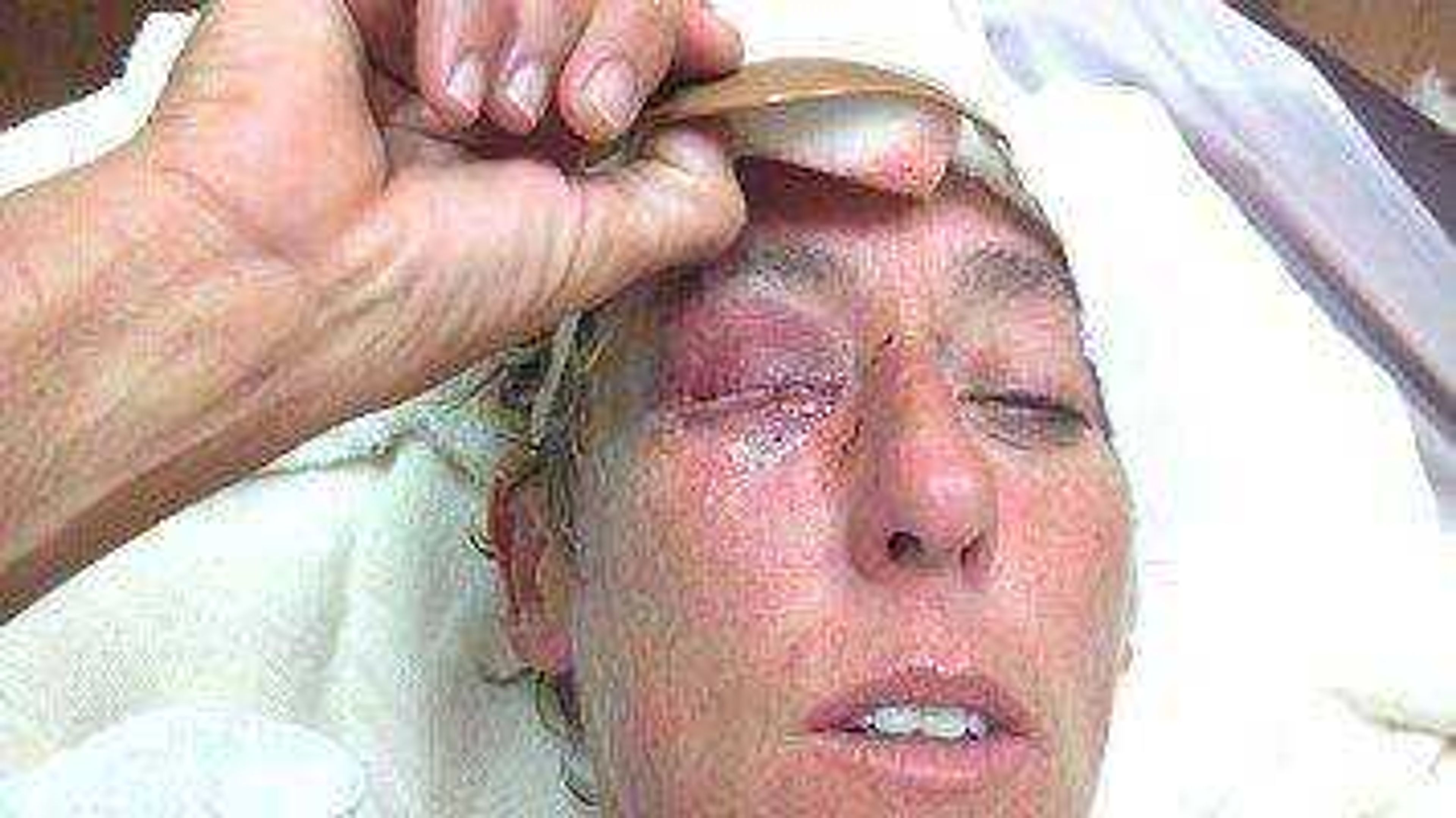 Jeana Terry shows the facial injuries she received July 24 after she said she was beaten by three siblings who live in her neighborhood. Terry and her partner believe the incident should be regarded as a hate crime because they say the alleged beating was motivated by the sibling's discrimination of their sexual orientation.