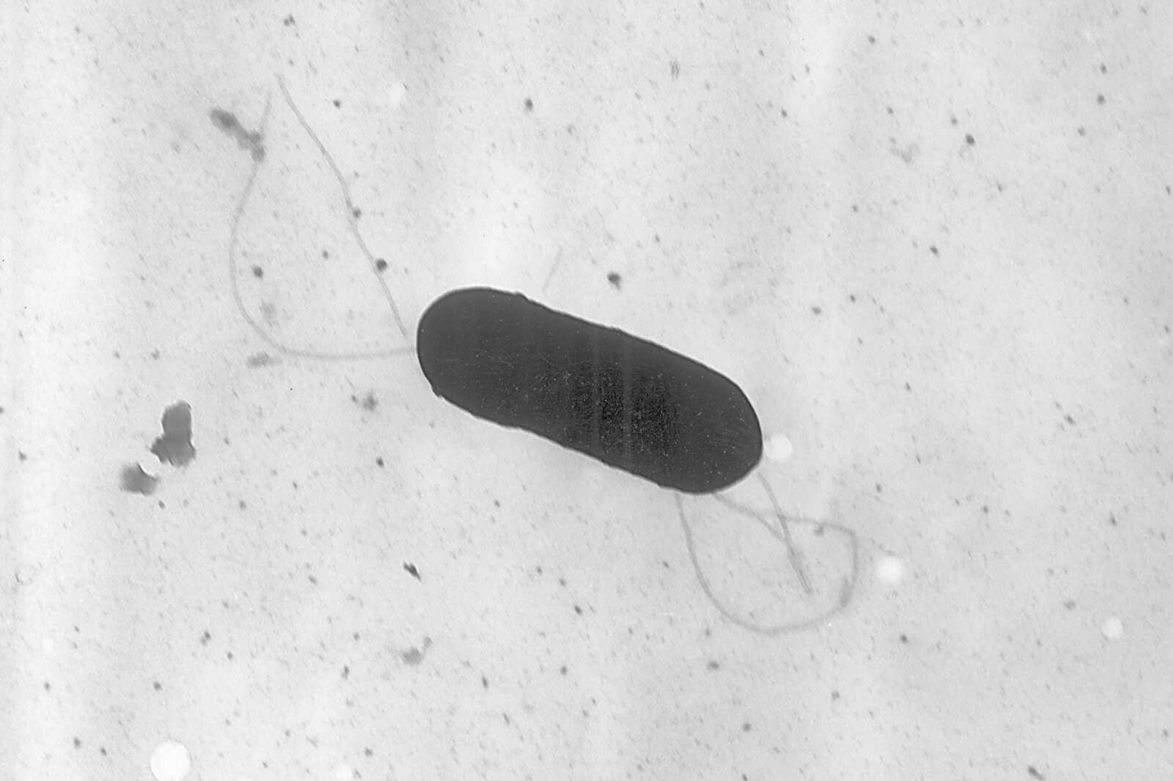 This 2002 electron microscope image, a Listeria monocytogenes bacterium, responsible for the food borne illness listeriosis. On Wednesday, Nov. 9, U.S. health officials said at least one death and a pregnancy loss are tied to an outbreak of listeria food poisoning associated with sliced deli meats and cheeses that has sickened 16 people in six states, including 13 who were hospitalized.