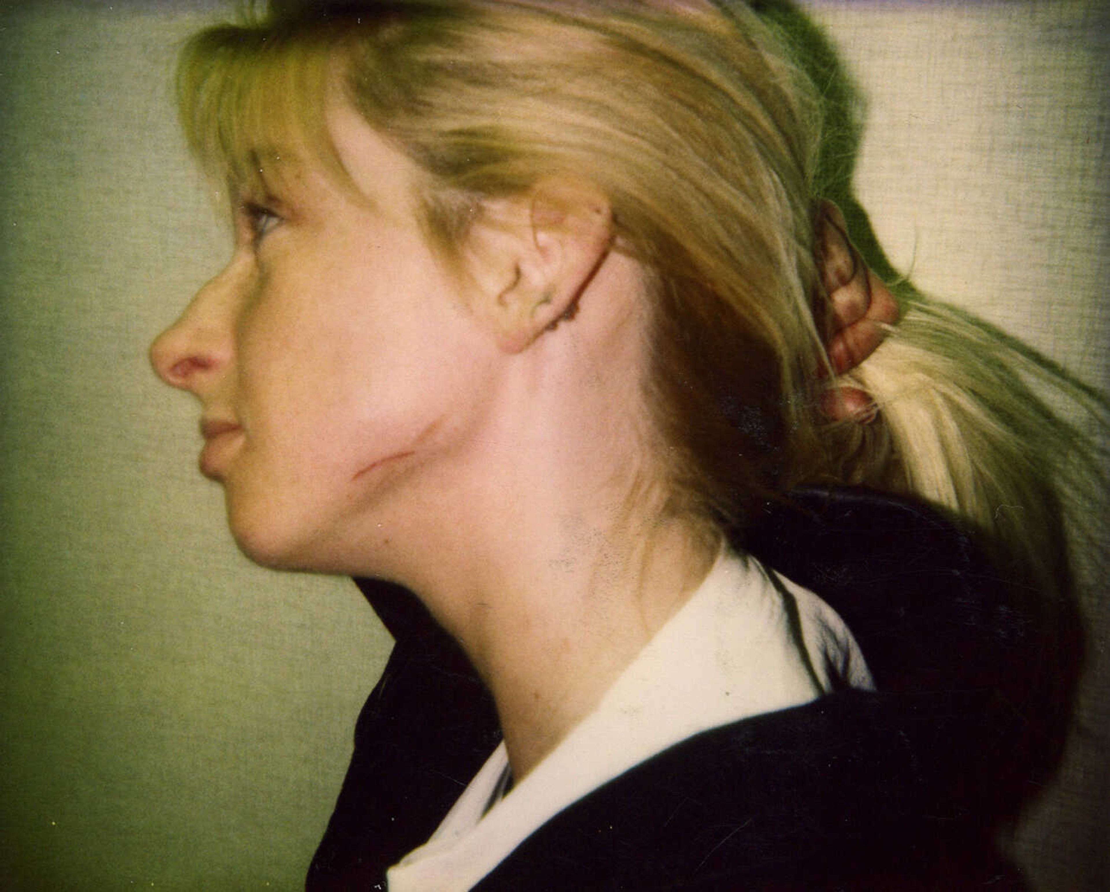 Stephanie Ray Pruitt shows police a cut on her face inflicted by Russell Bucklew. (Submitted photo)