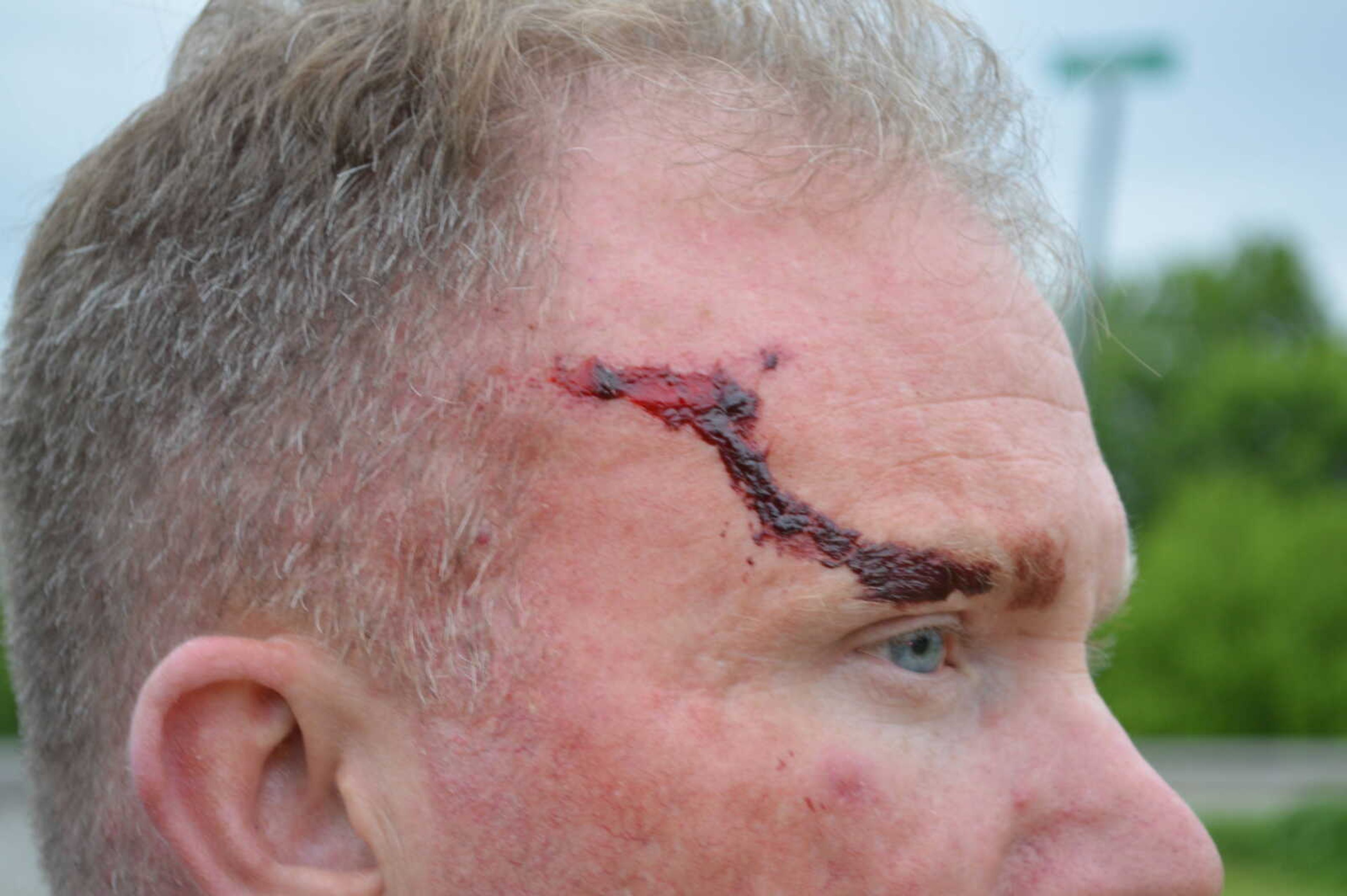 A photo submitted into evidence shows wounds trooper Jason McBride sustained on his face during the altercation. 