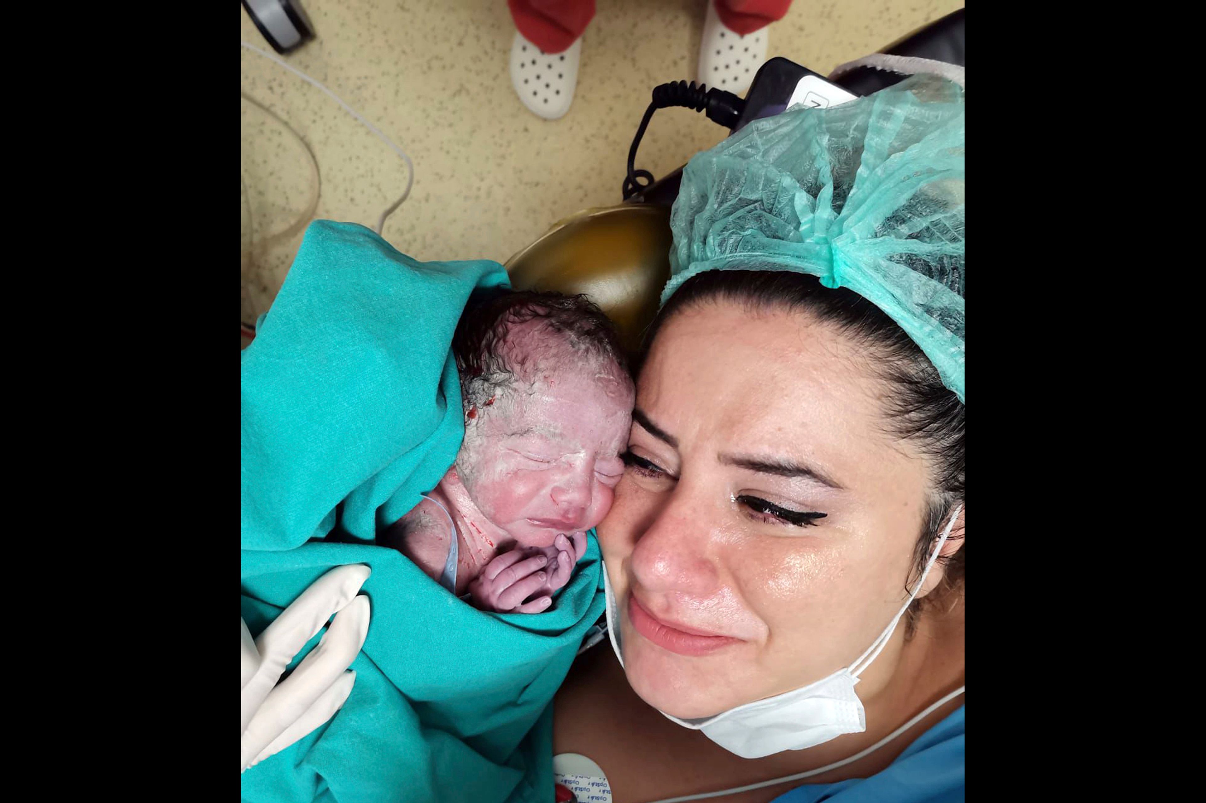 In this photo provided by the Gokdeniz family, Burcu Gokdeniz holds her newborn baby Umut Ali Gokdeniz for the first time moments after the preterm birth in Istanbul, Turkey, Tuesday, Aug. 25, 2020. (Gokdeniz family via AP)