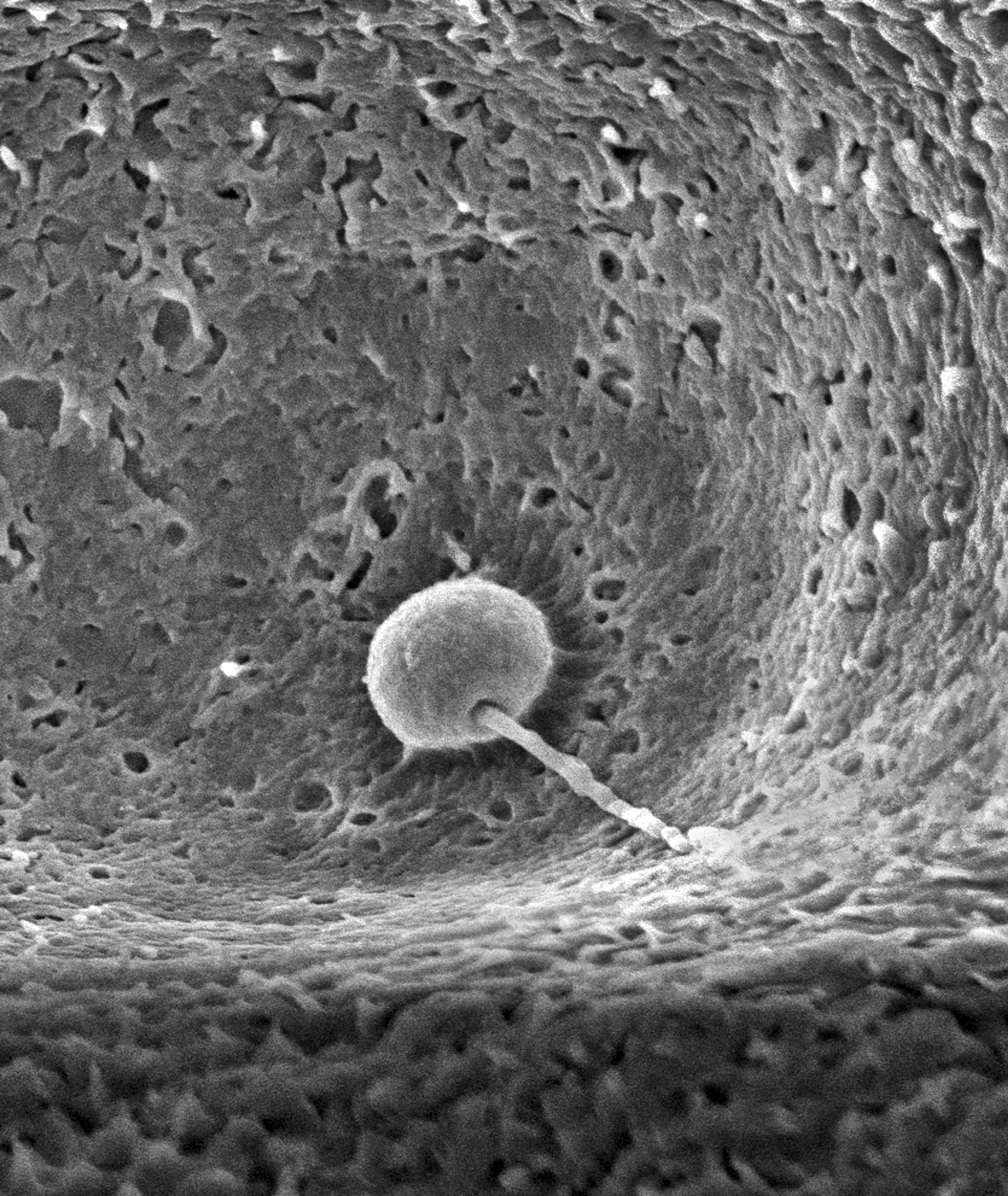 This electron microscope image provided by the Research Institute of Molecular Pathology in October 2024, shows a zebrafish sperm bound to the sperm-entry site of a zebrafish egg. (IMP via AP)