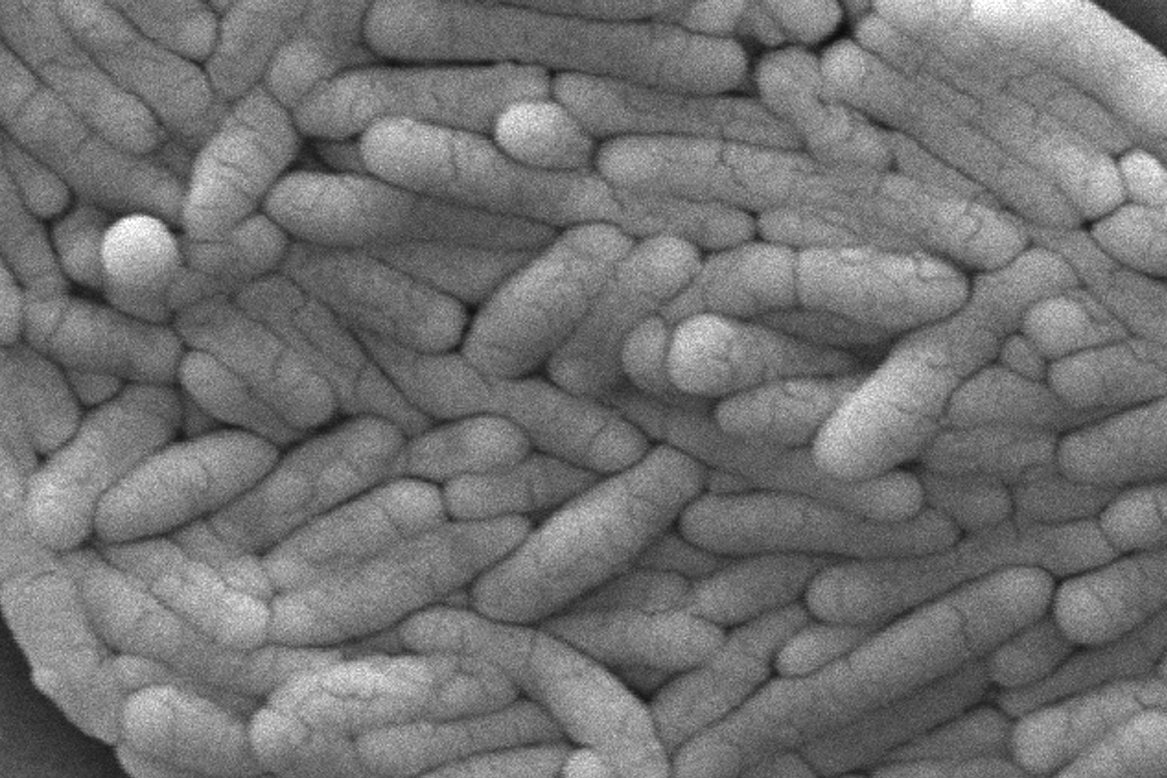 New salmonella outbreak is linked to backyard poultry, CDC says