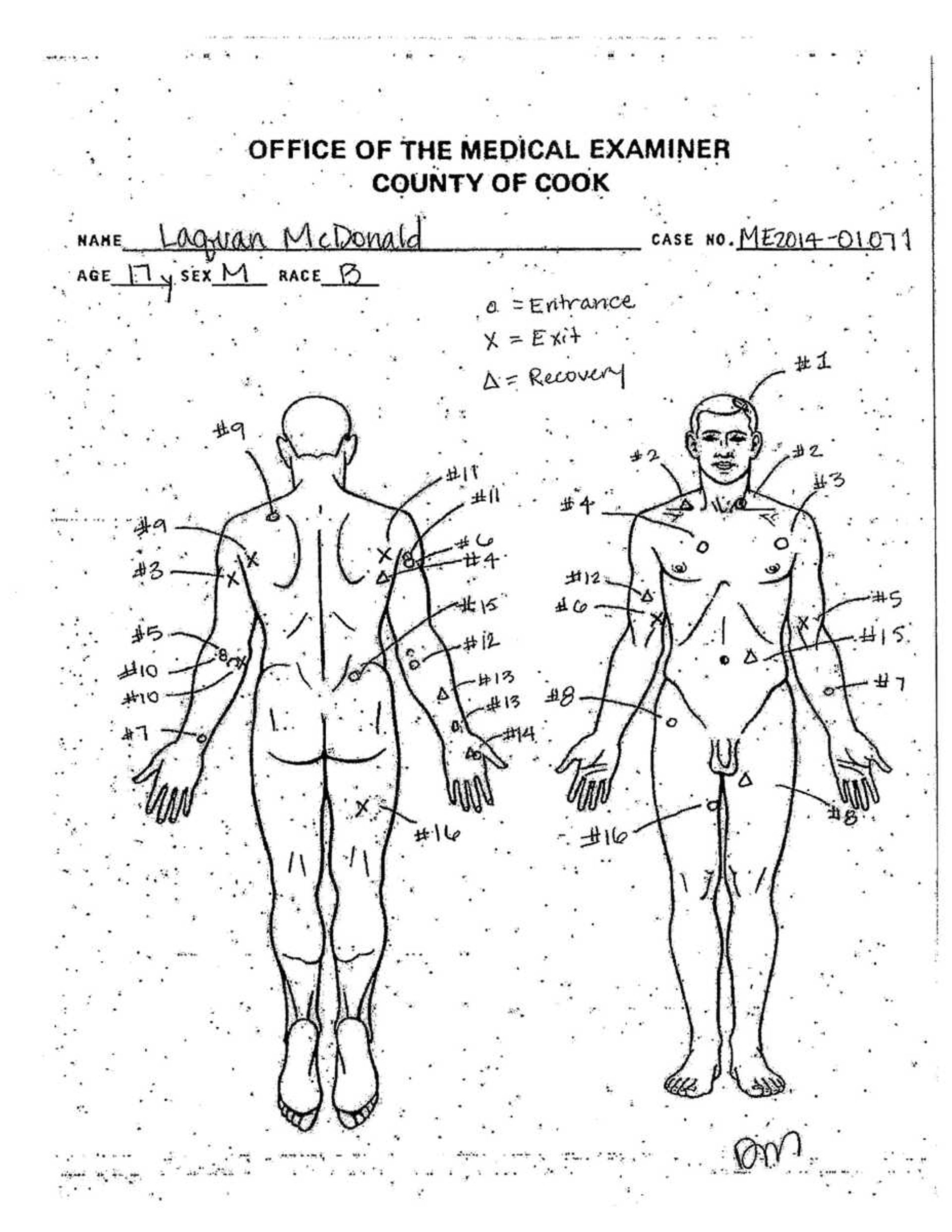 This autopsy diagram provided by the Cook County Medical Examiner's office shows the location of wounds on the body of 17-year-old Laquan McDonald, who was shot by a Chicago Police officer 16 times in 2014. A judge ordered the city to release squad car dashcam video of the shooting by today. (Cook County Medical Examiner via AP)