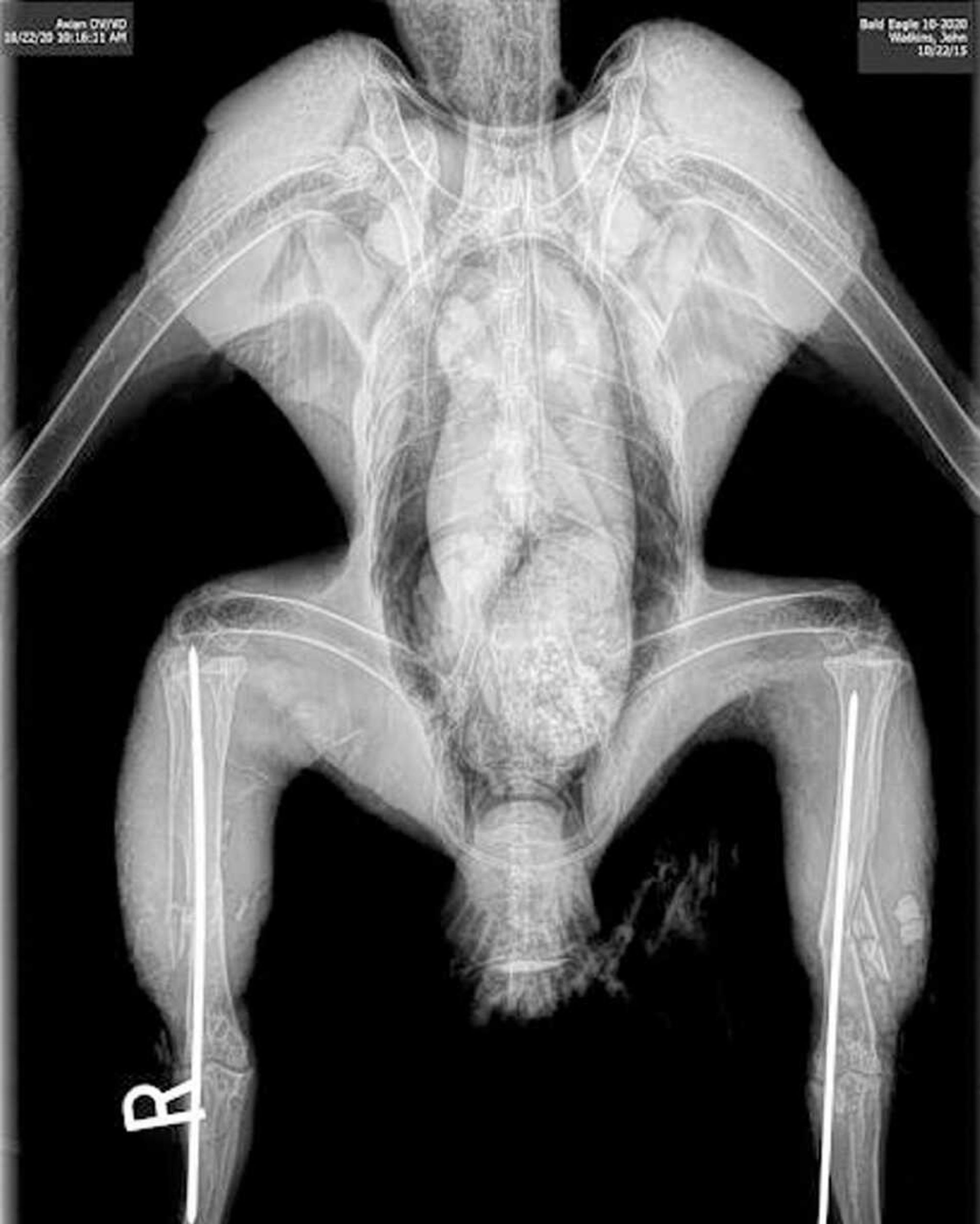 An X-ray of the bald eagle.