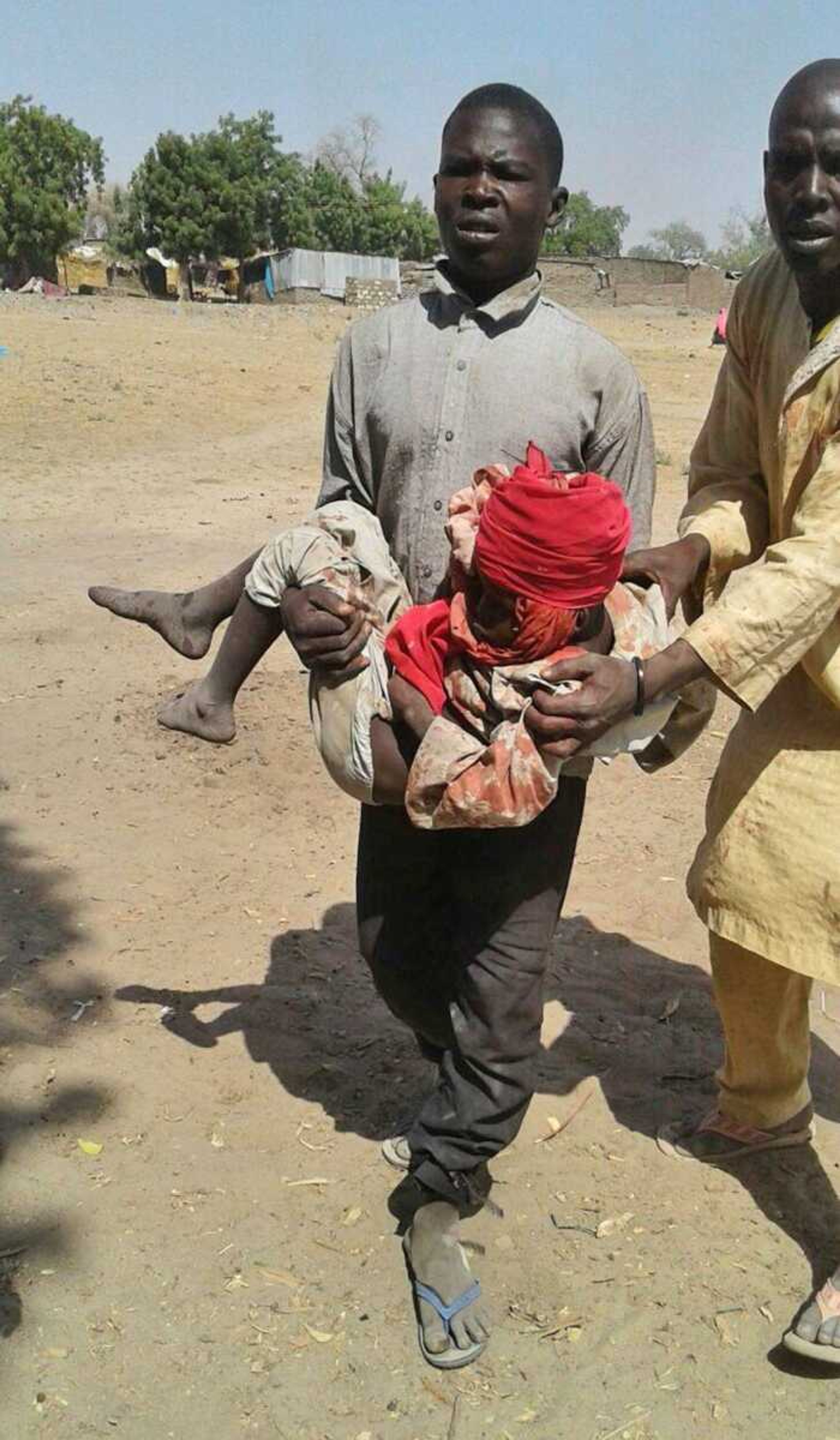 A man carries an injured child after a military air strike Tuesday at a camp for displaced people in Rann, Nigeria.