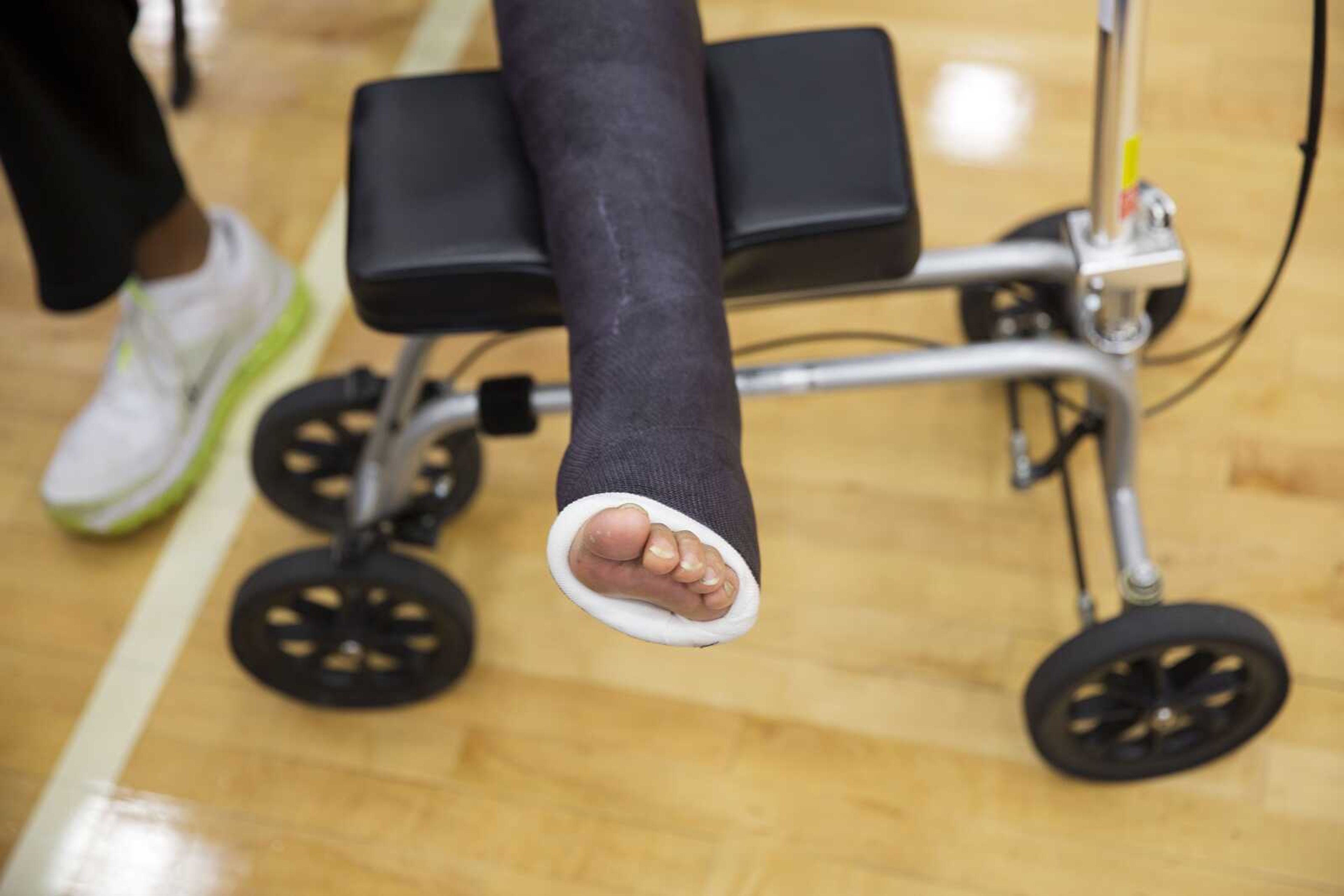 The foot of Georgia State head basketball coach Ron Hunter rests in a cast as he talks to the media March 16, 2015, in Atlanta. Hunter tore his Achilles tendon. New research suggests surgery may not be needed for most Achilles tendon tears.