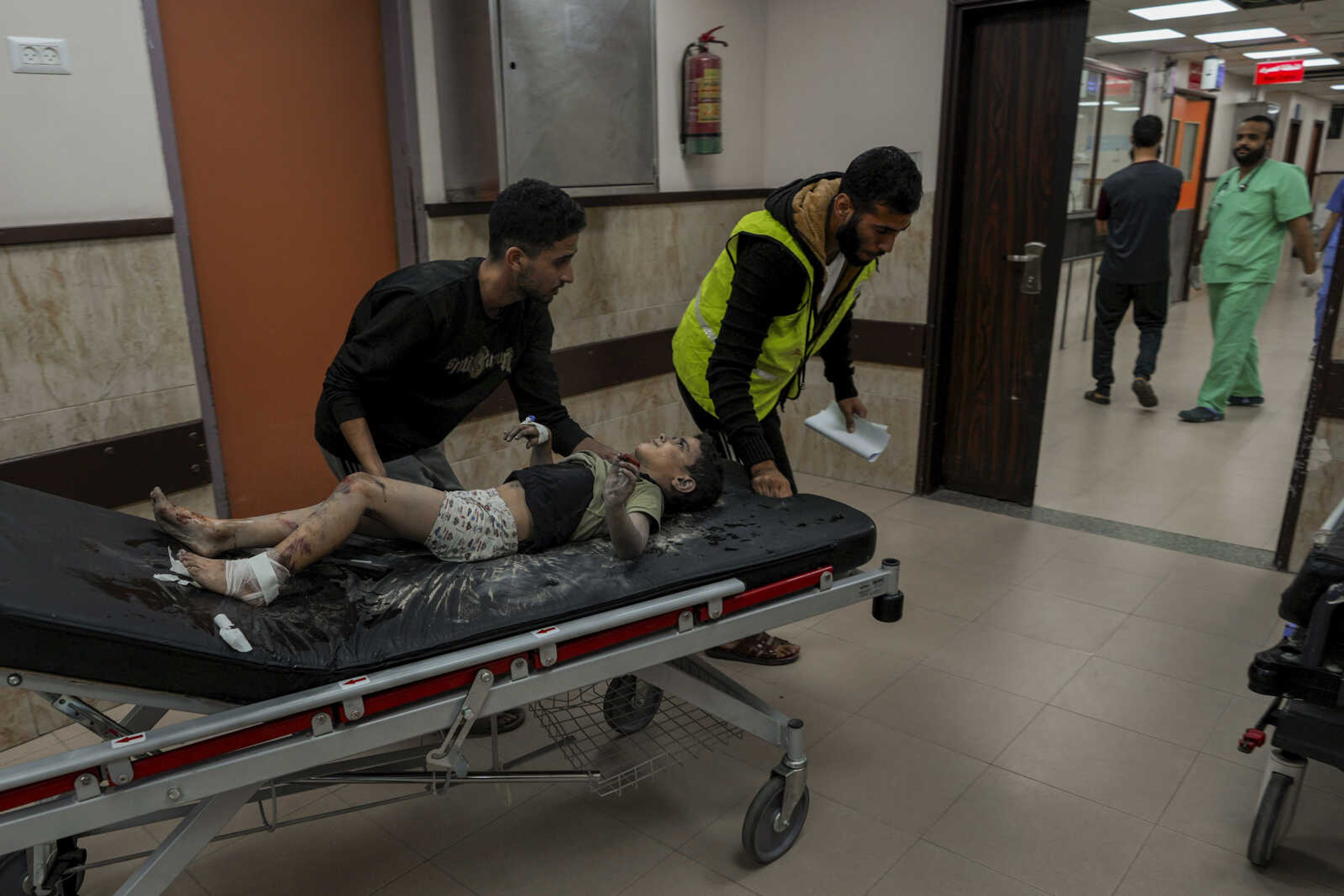 A Palestinian child wounded during an Israeli airstrike is rushed into al-Aqsa hospital Sunday in Deir el-Balah, central Gaza Strip.