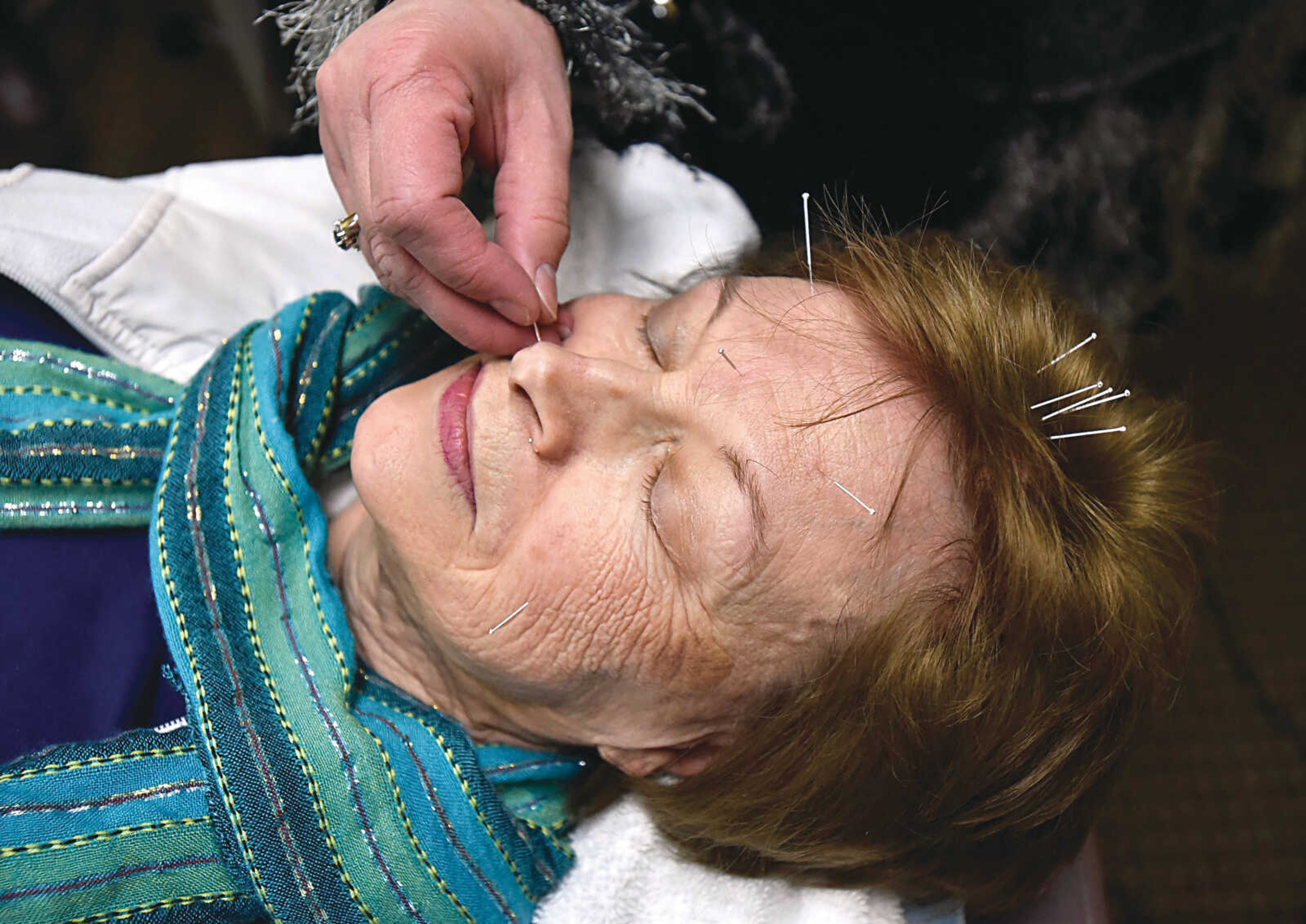 Dr. Anne Heisserer, DC, performs acupuncture on Shirley Bentley.