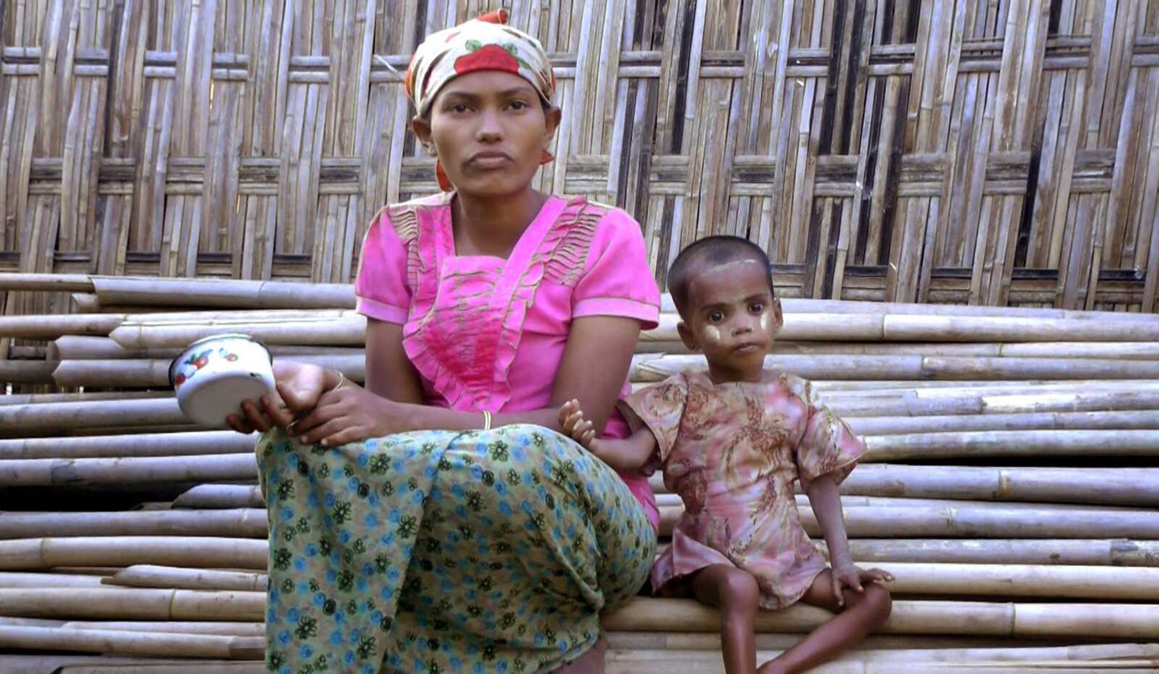 Rosmaida Bibi, right, who suffers from severe malnutrition, sits with her 20-year old mother, Hamida Begum, outside their makeshift shelter at the Dar Paing camp in Myanmar. Rosmaida Bibi looks a lot like any of the underfed 1-year-olds in a squalid camp for Myanmar's displaced ethnic Rohingya minority, but she's 4. She cannot grow, and her mother can't find anyone to help her.