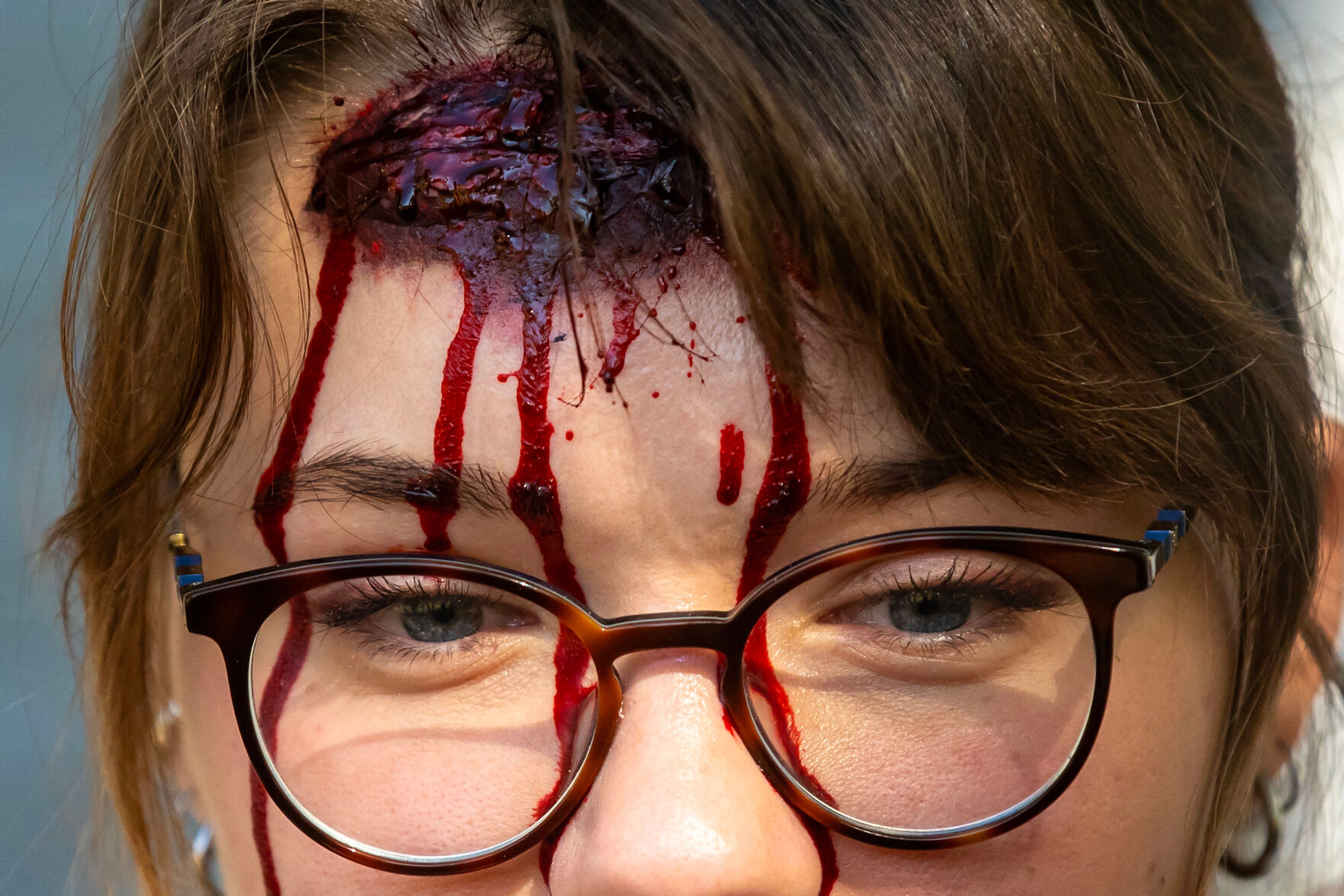 Brooke McKenzie sports a bleeding head wound during a disaster simulation of a windstorm Saturday at the Latah County Fairgrounds.