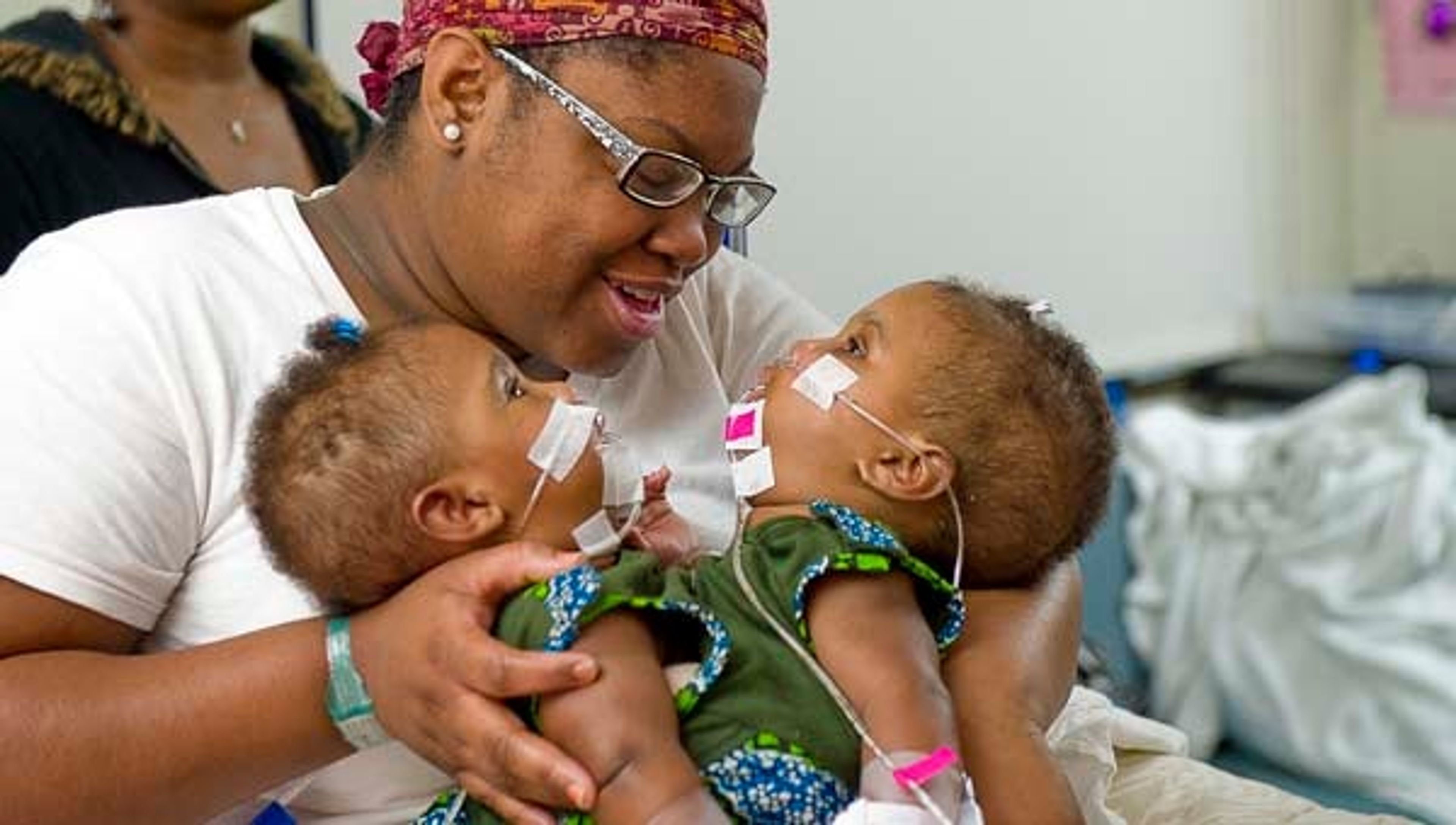 Conjoined twins successfully separated, image size:3840x2176