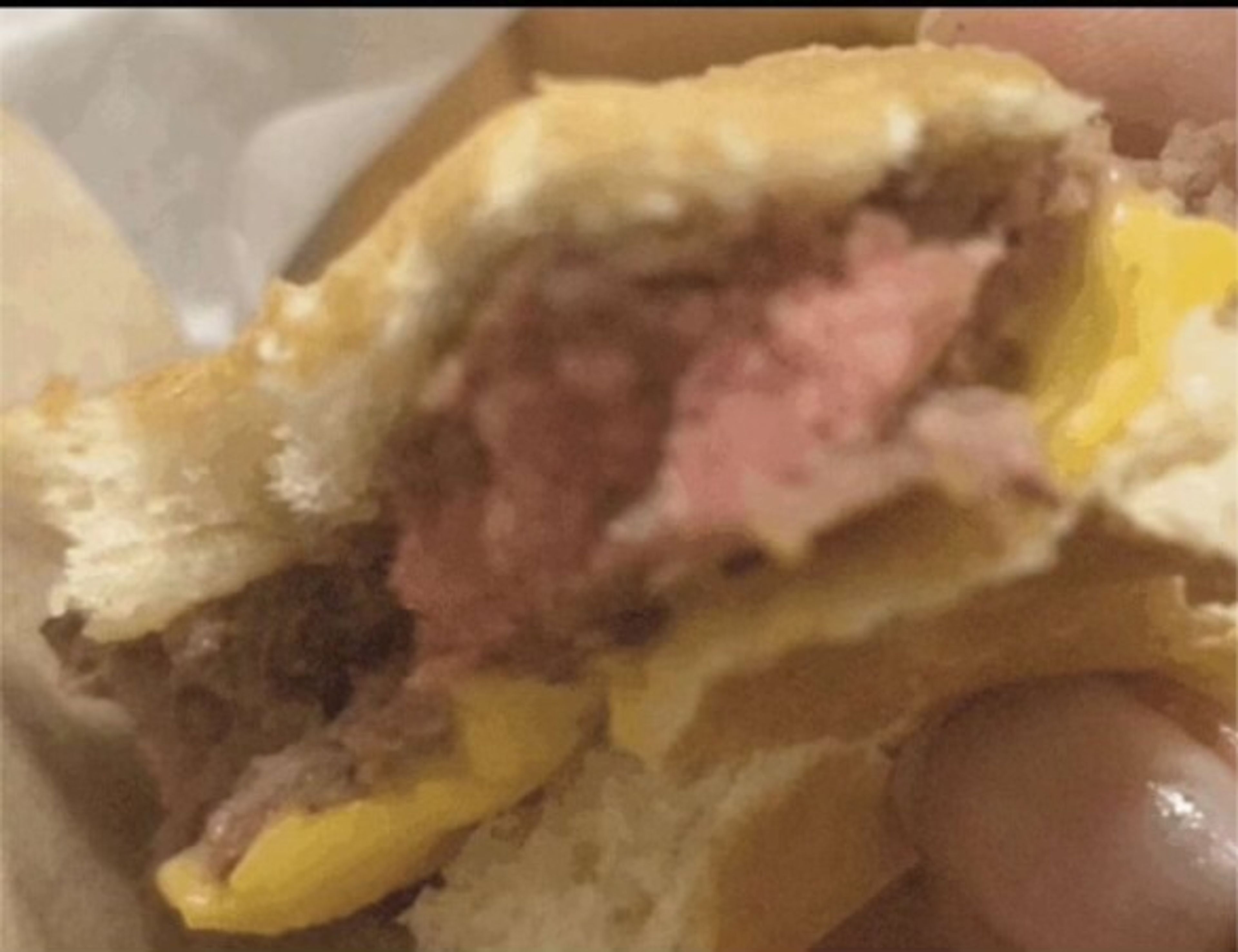 An undercooked burger served to a student from Broadway Street Burgers.